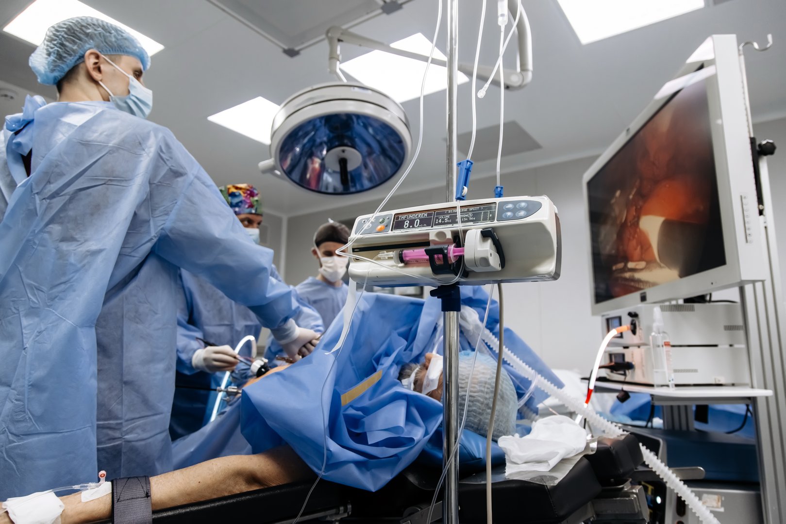 A group of medical surgeons in the operating room during an operation. A patient on the operating table during laparoscopic abdominal surgery. The concept of modern medical equipment.