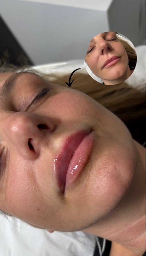 Lily Dot Aesthetics Work