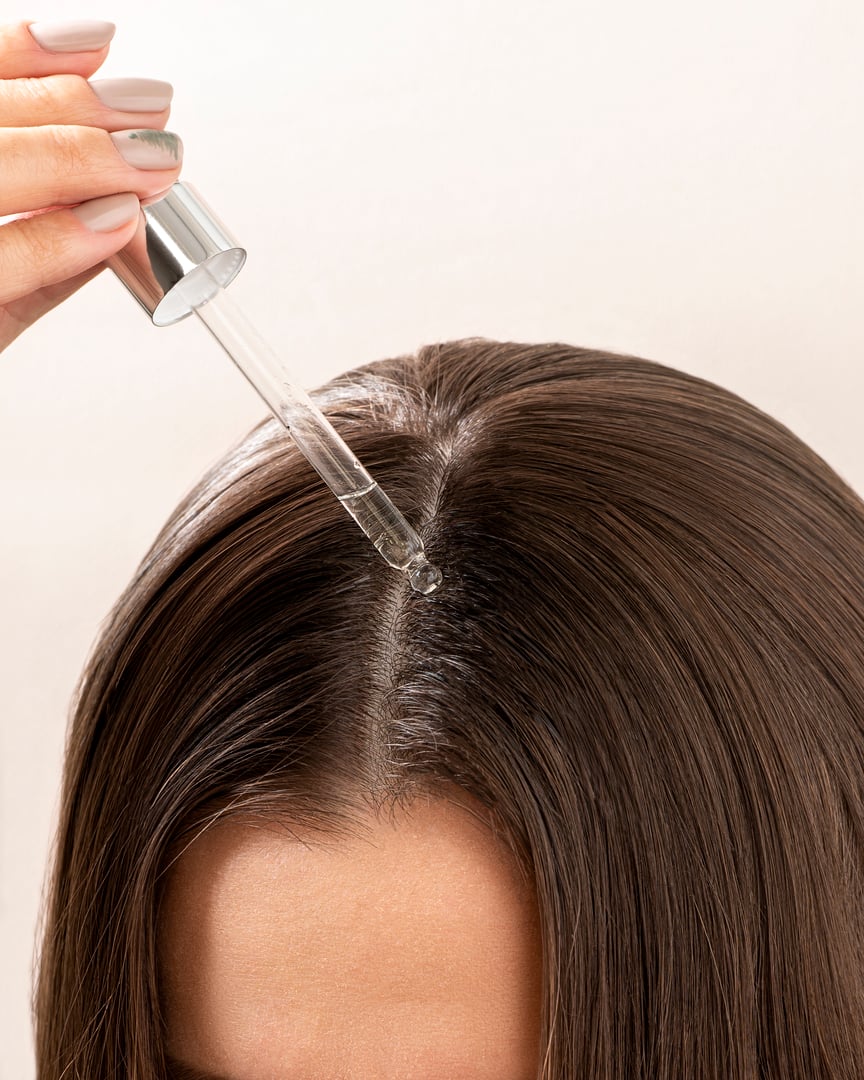 A young woman applies a drop of oil from a pipette to her scalp, close-up. Vitamins, keratin for treatment, strengthening and growth of hair. Problems with dandruff, hair loss. Hair care concept