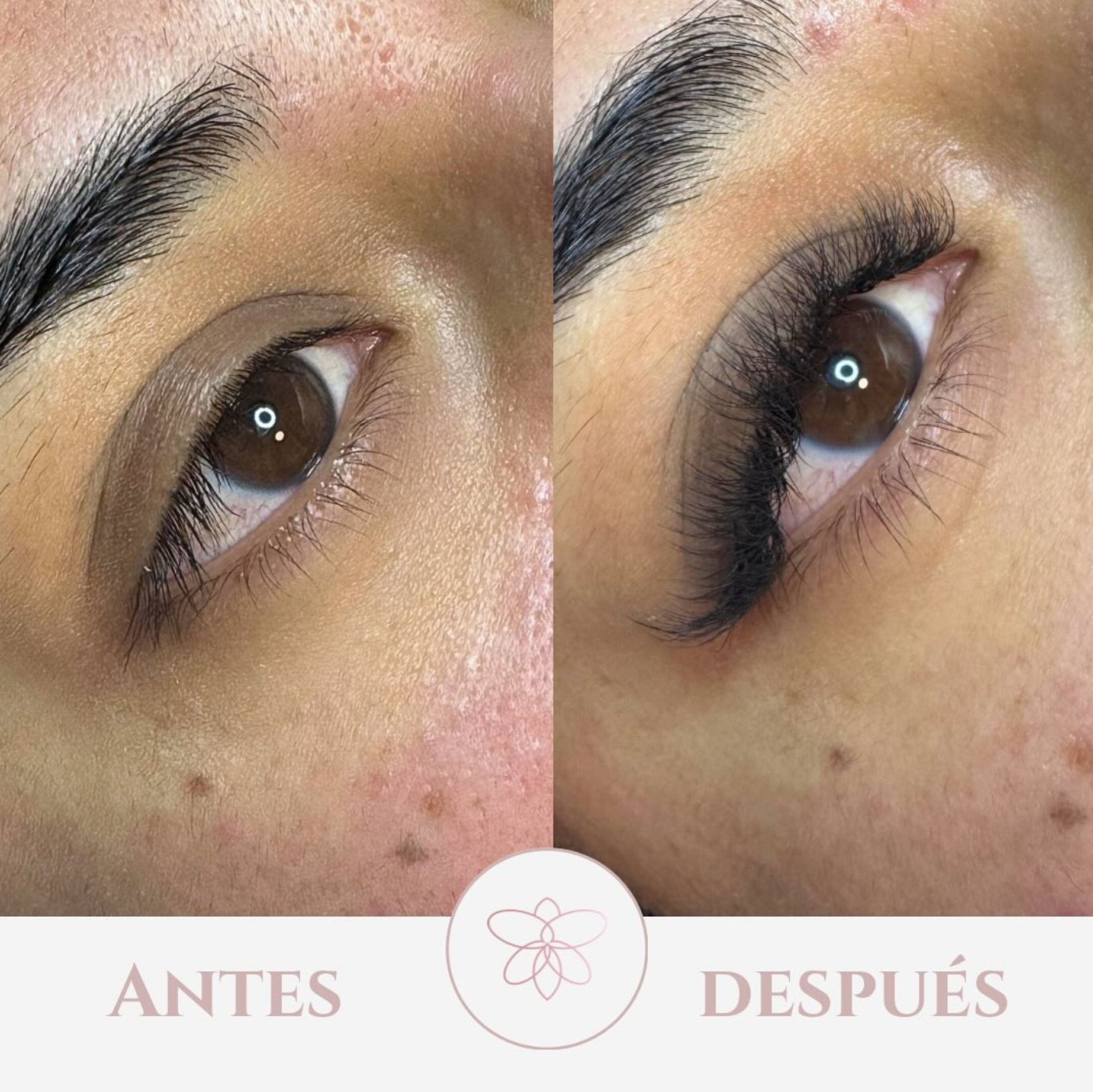 Resultados de tratamiento facial - Antes y Después