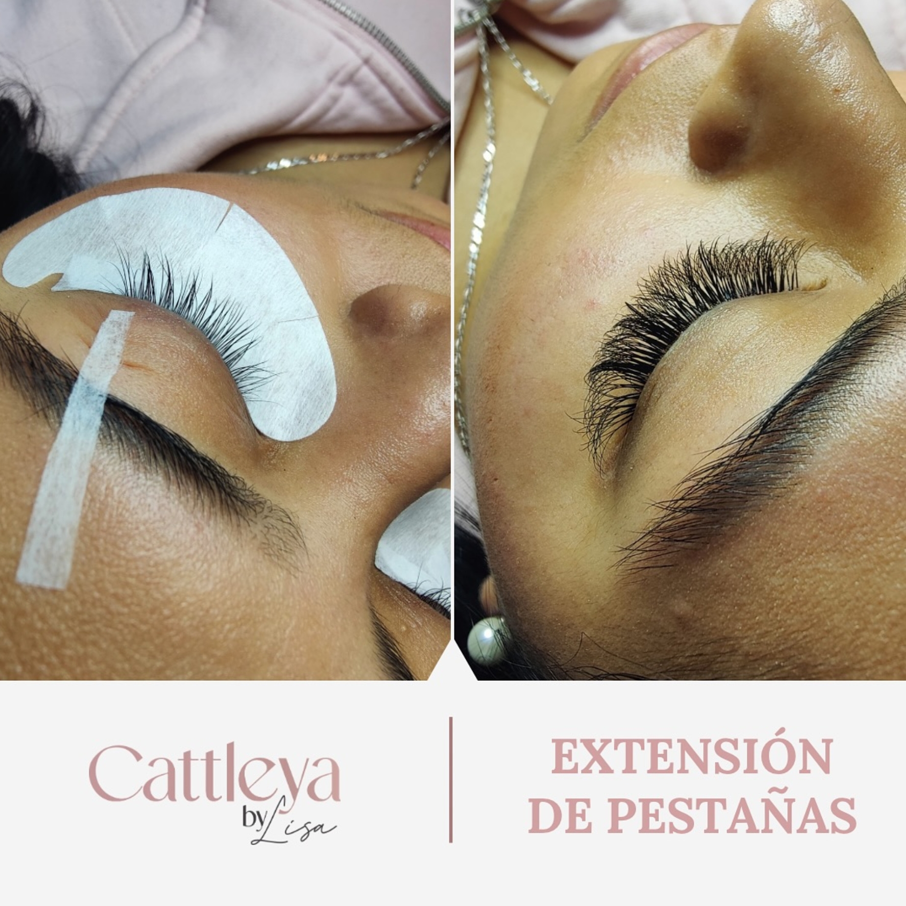 Resultados de tratamiento facial - Antes y Después