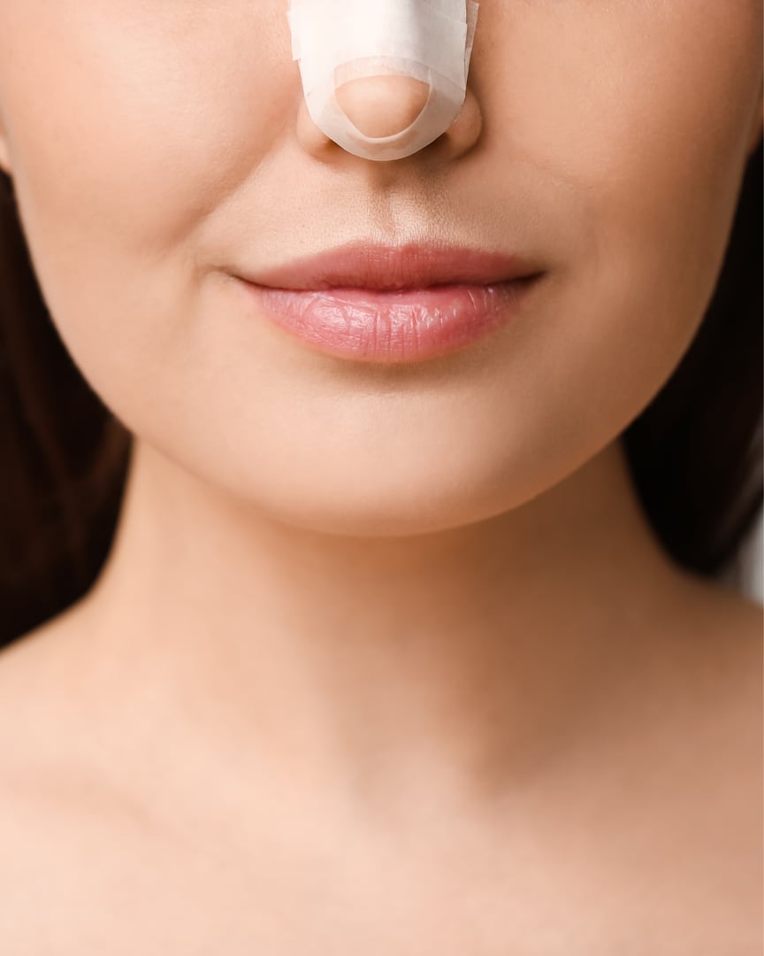 Plastic surgery procedures