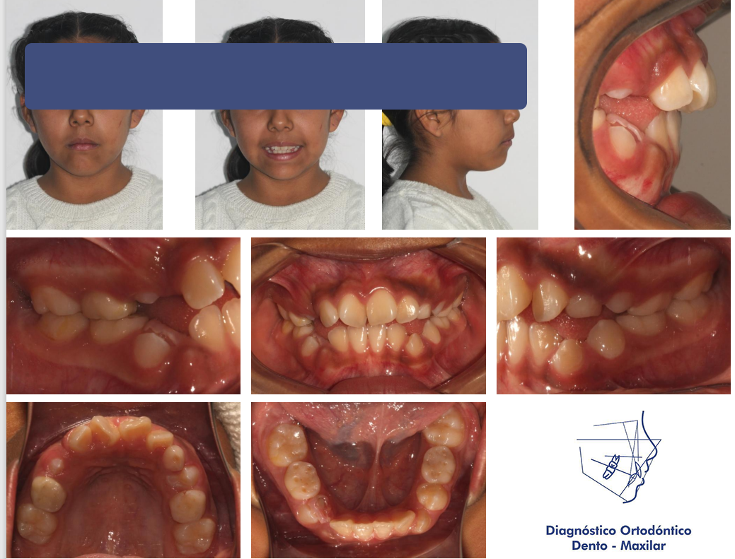 Radiografía dental