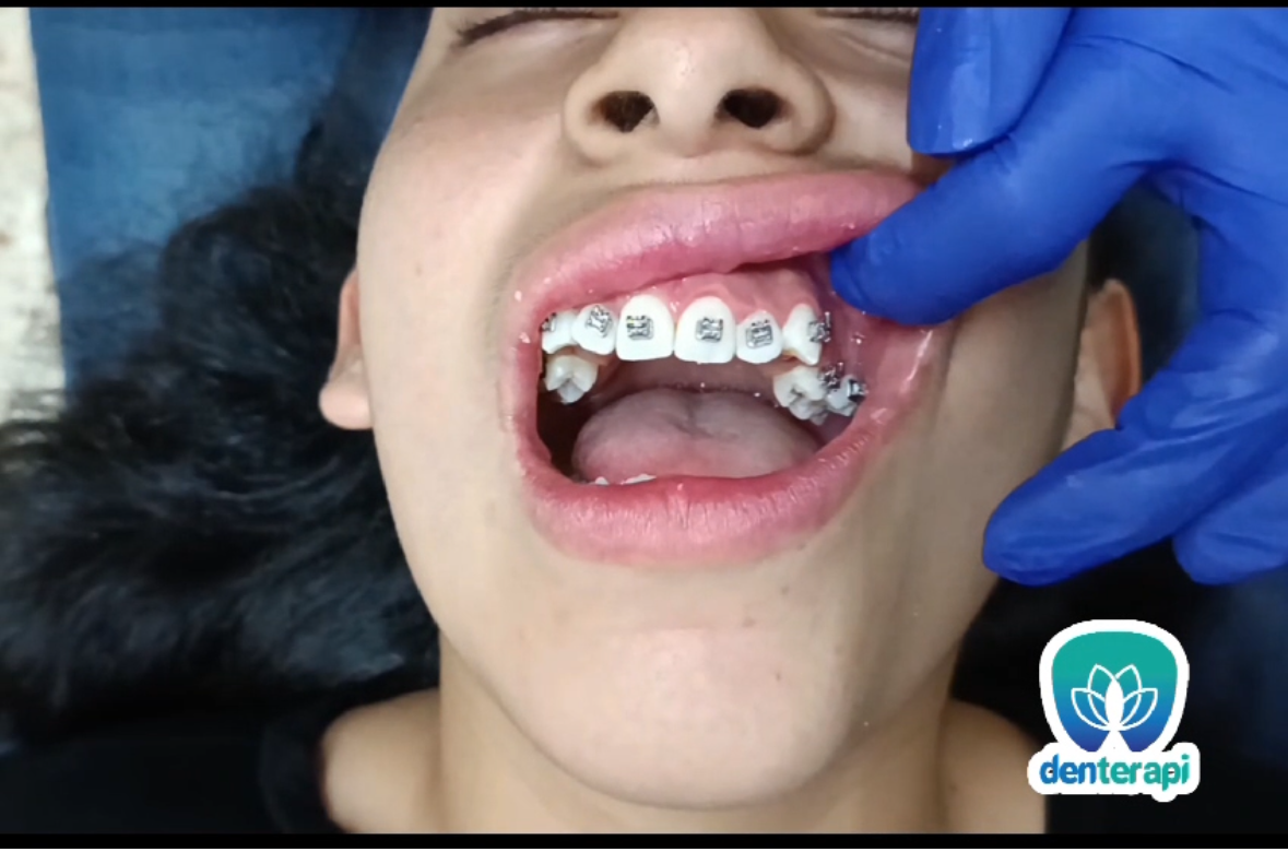 Denterapi Clínica Dental