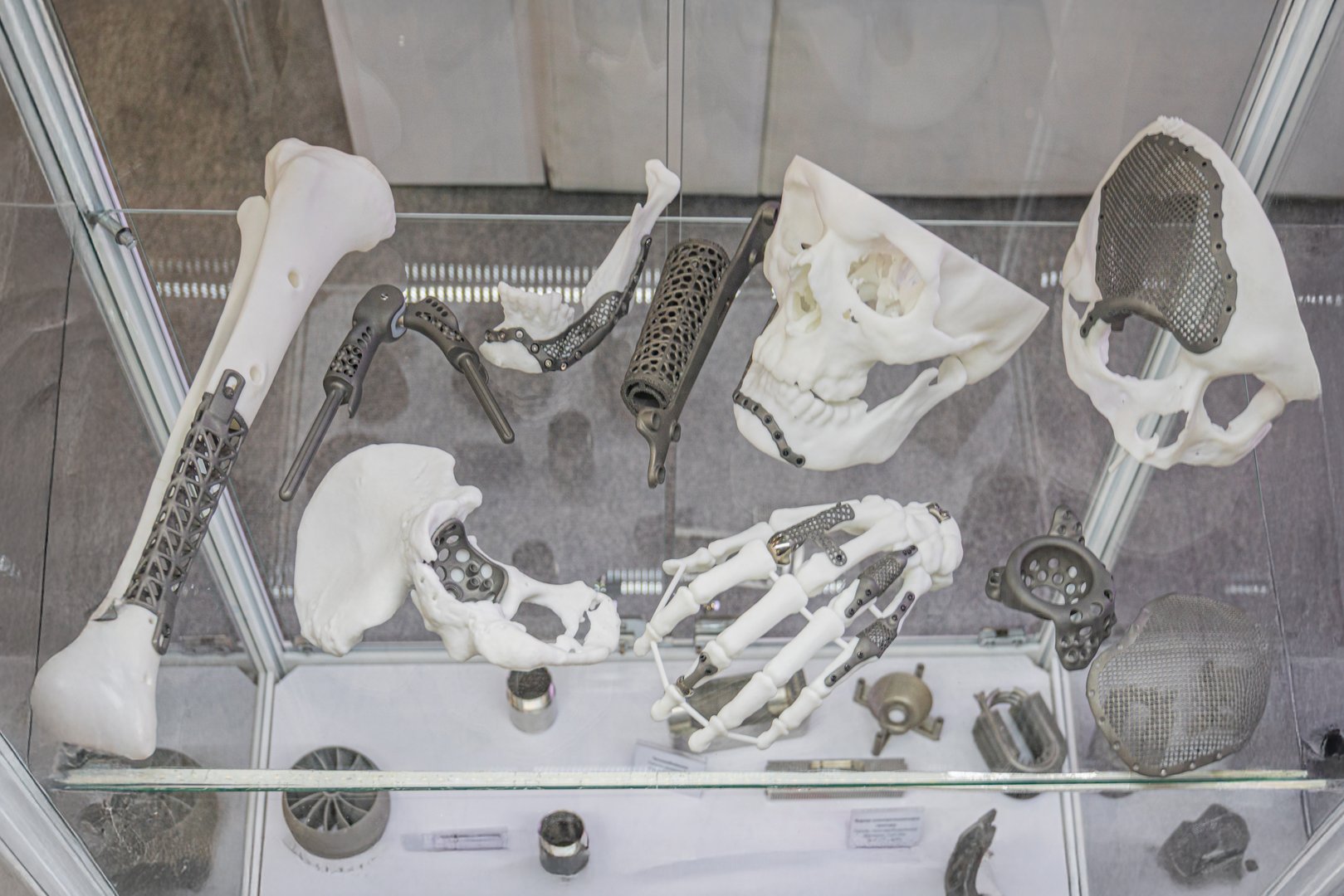 Close-up of 3D printed titanium dentures, displayed in a museum exhibit showcasing human skeletal anatomy models and metal medical tools