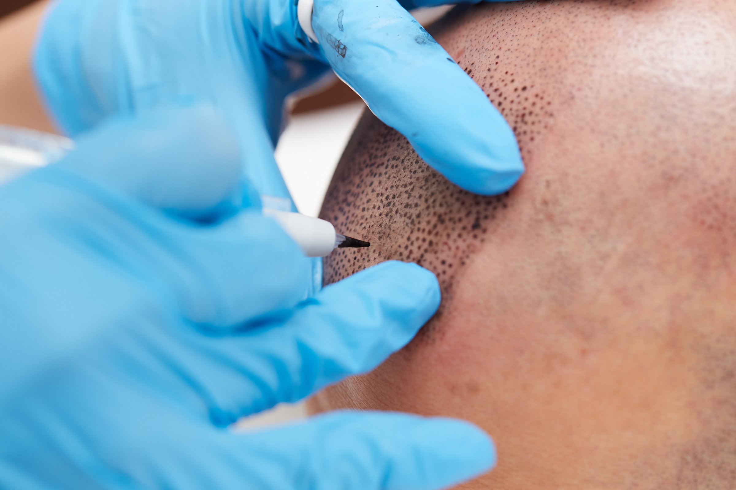 Professional tattooist making permanent make up tricopigmentation