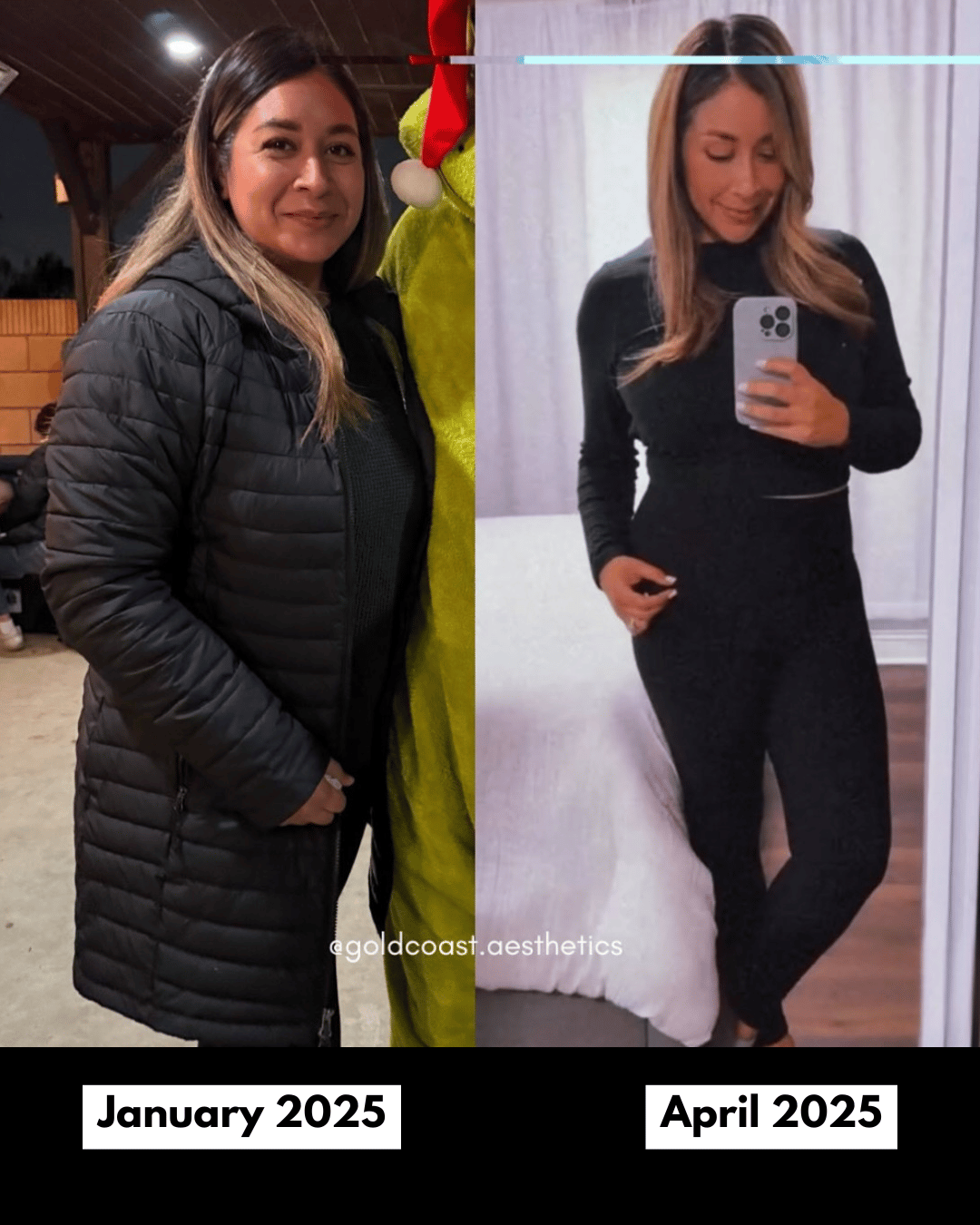 Tirzepatide transformation before and after