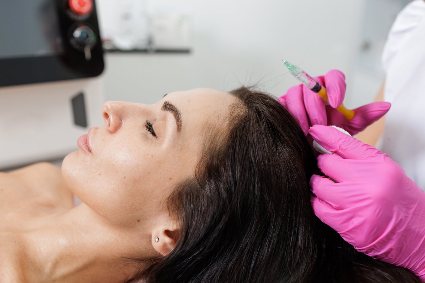 Woman receiving scalp mesotherapy injection for hair loss and thinning, noninvasive hair restoration in modern trichology clinic.