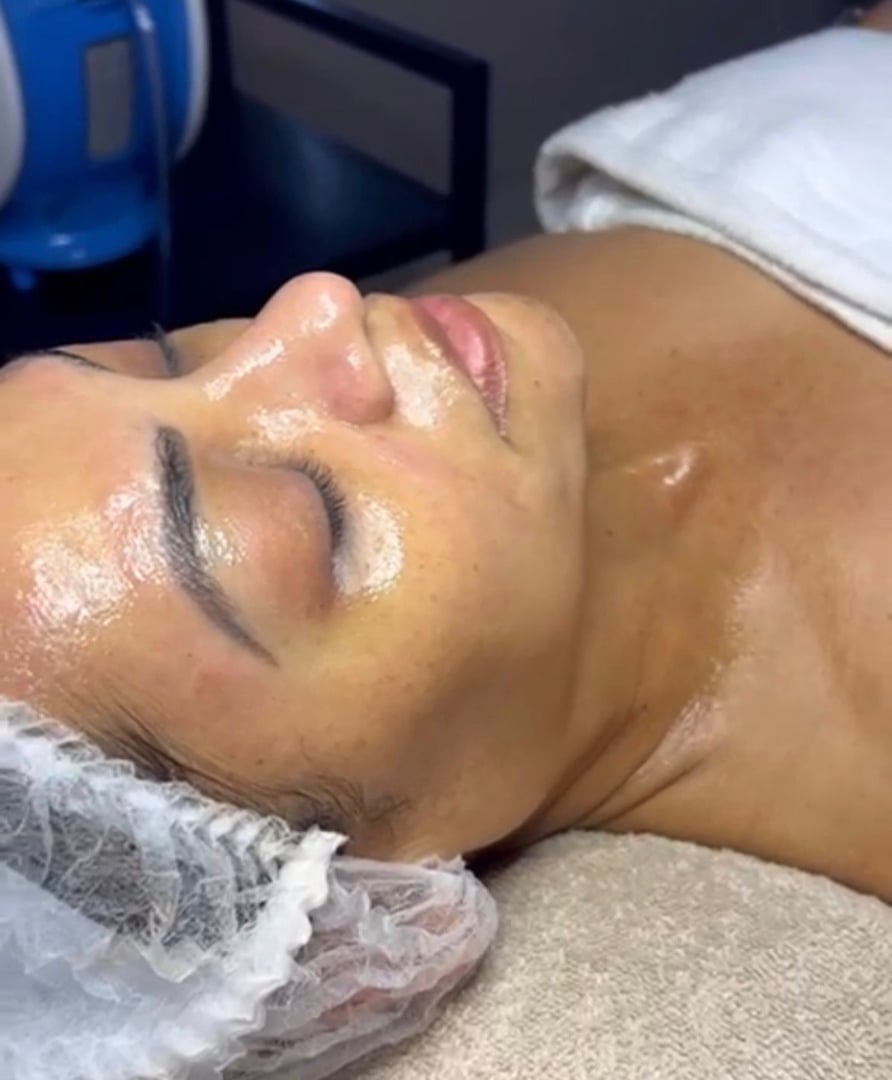 Tratamiento DNA de Salmón