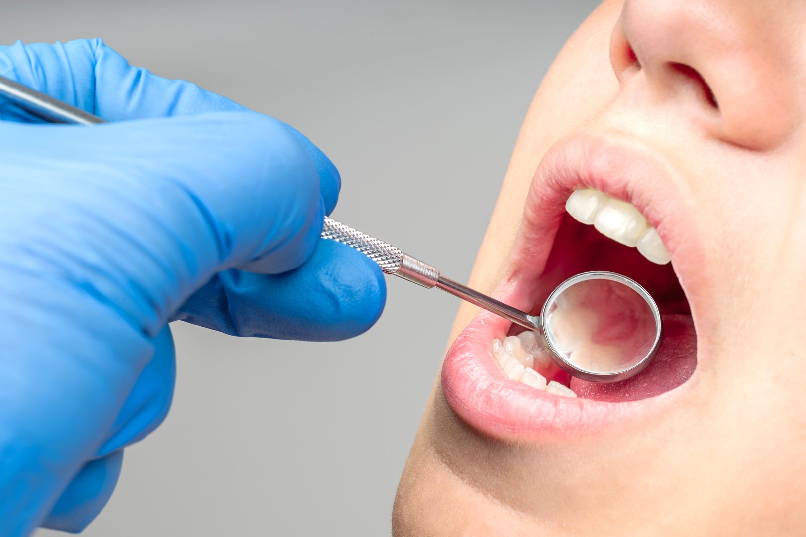 Close up of dentist hand examining patient teeth with dental mirror in checkup.