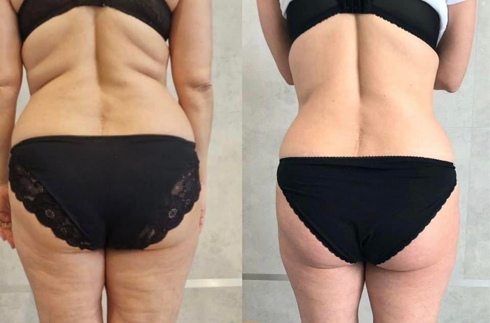 Efekt metamorfozy sylwetki - przed i po