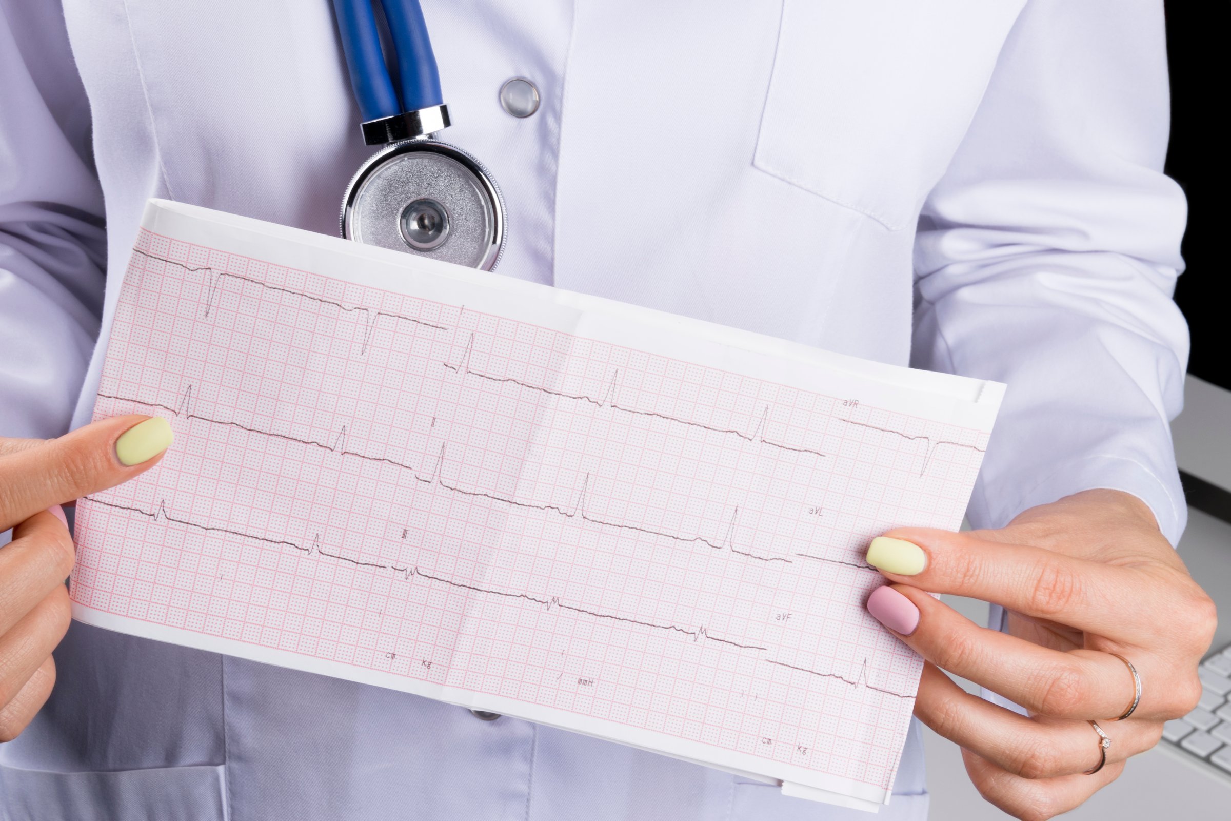 Electrocardiogram, ecg in hand of a female doctor. Medical health care. Clinic cardiology heart rhythm and pulse test closeup. Cardiogram printout.