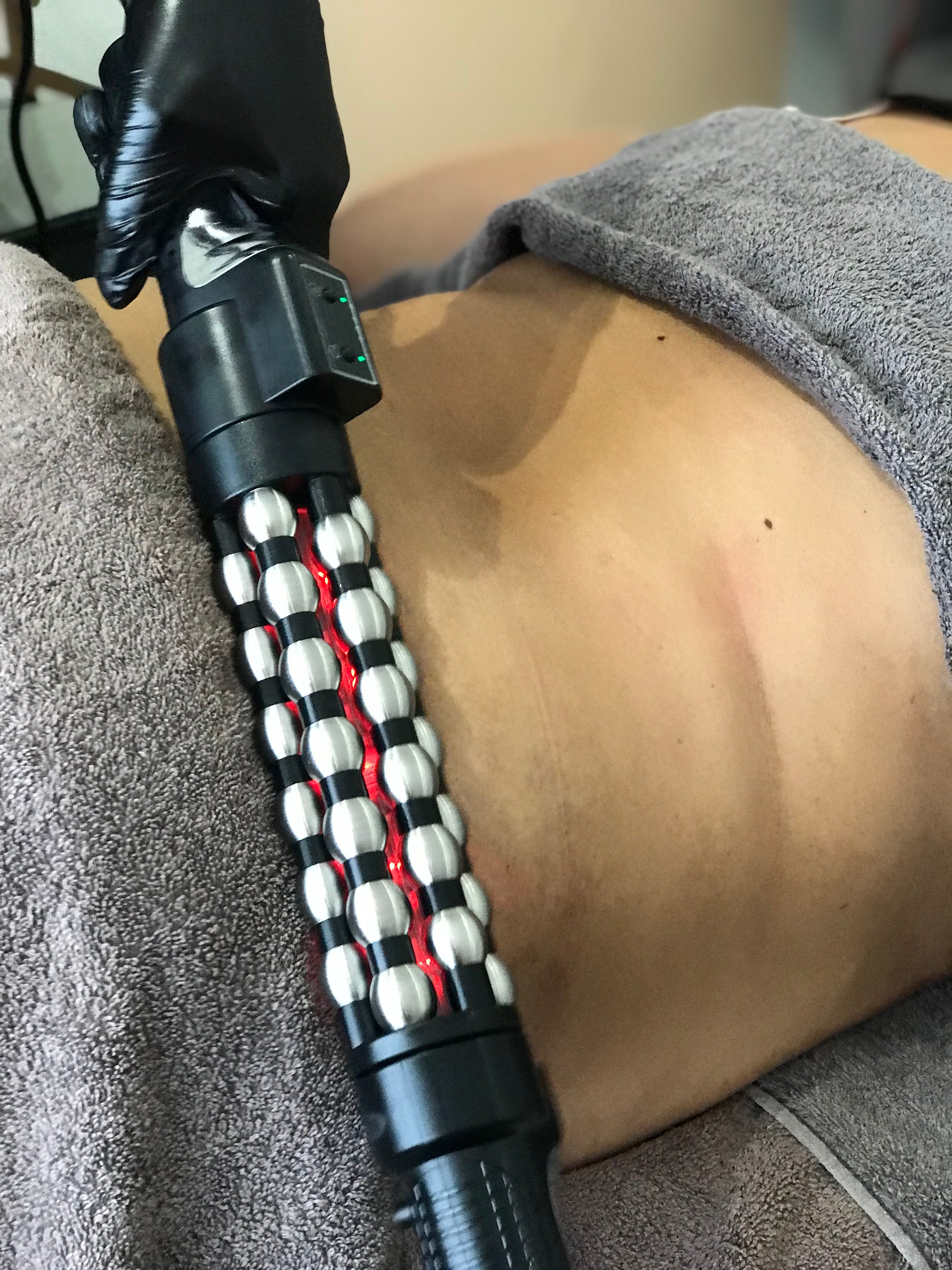 Close-up of a person receiving a massage with a metal roller device on their back, covered by a towel.