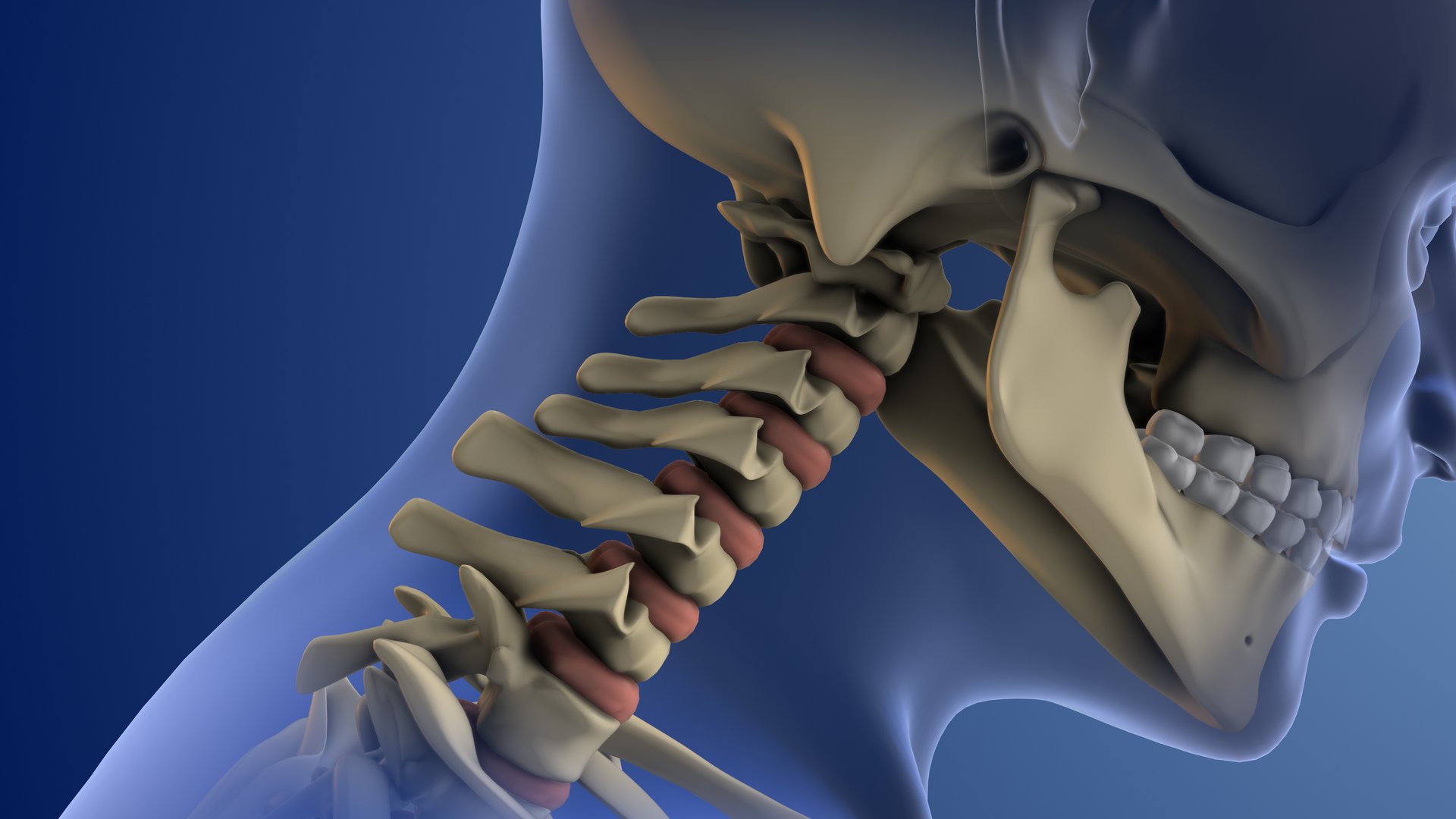 Cervical whiplash neck injury illustration