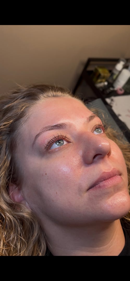 Treatment Room Setup