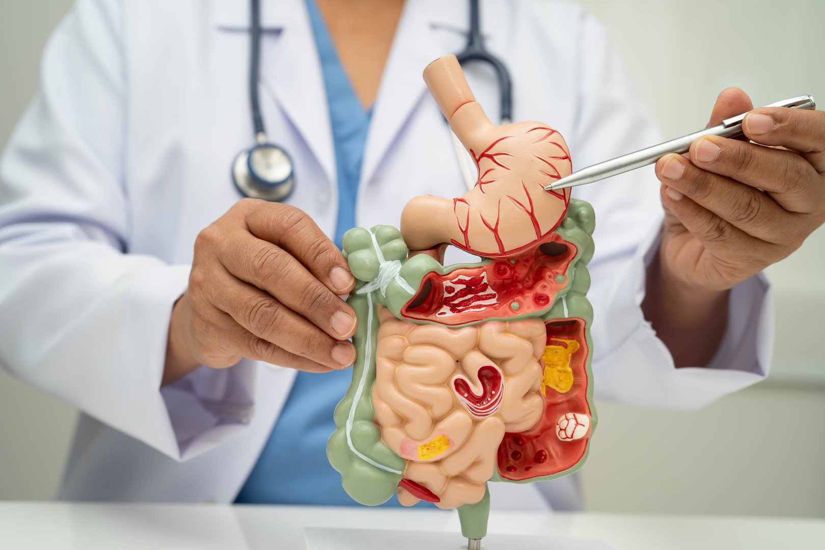 Digestive system with stomach and intestine, Asian doctor holding human anatomy model for study diagnosis and treatment in hospital.