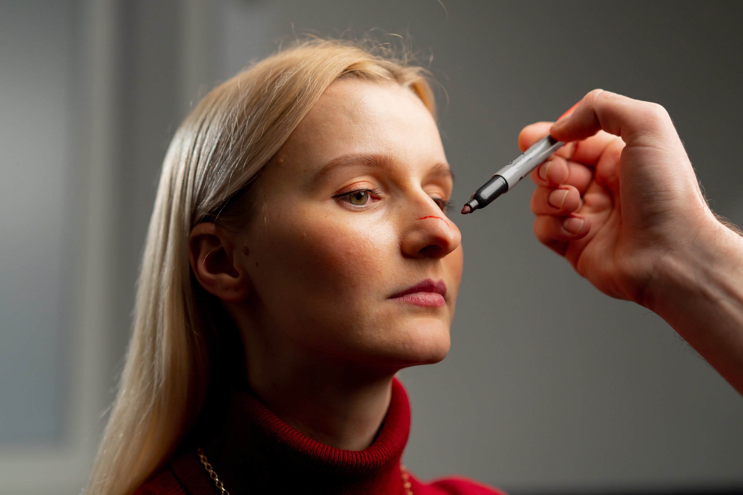 Detailed Rhinoplasty Surgical Procedure
