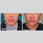 3RS MEDSPA Gallery Image