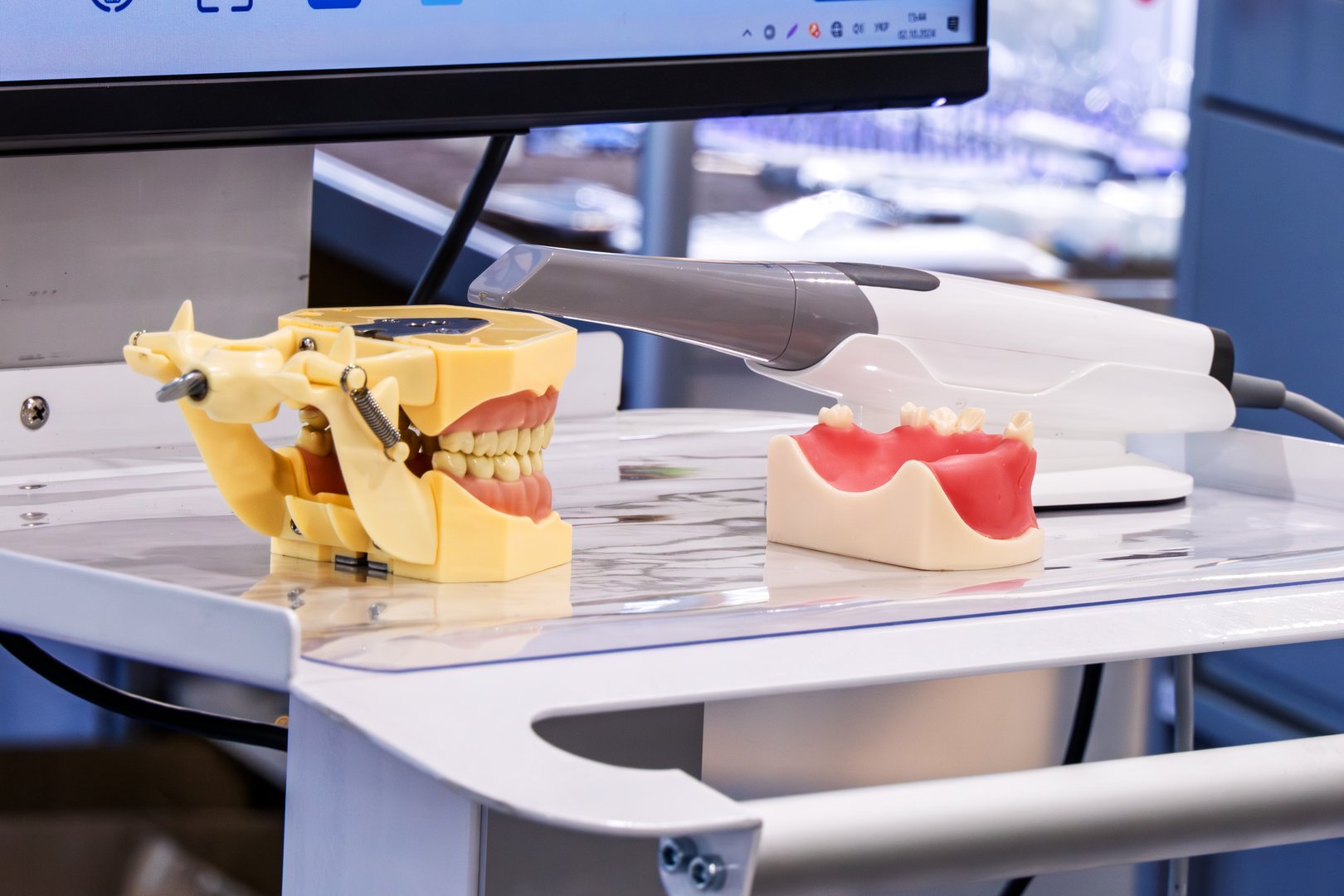 Fast intraoral scanner in dentistry with advanced artificial intelligence technology