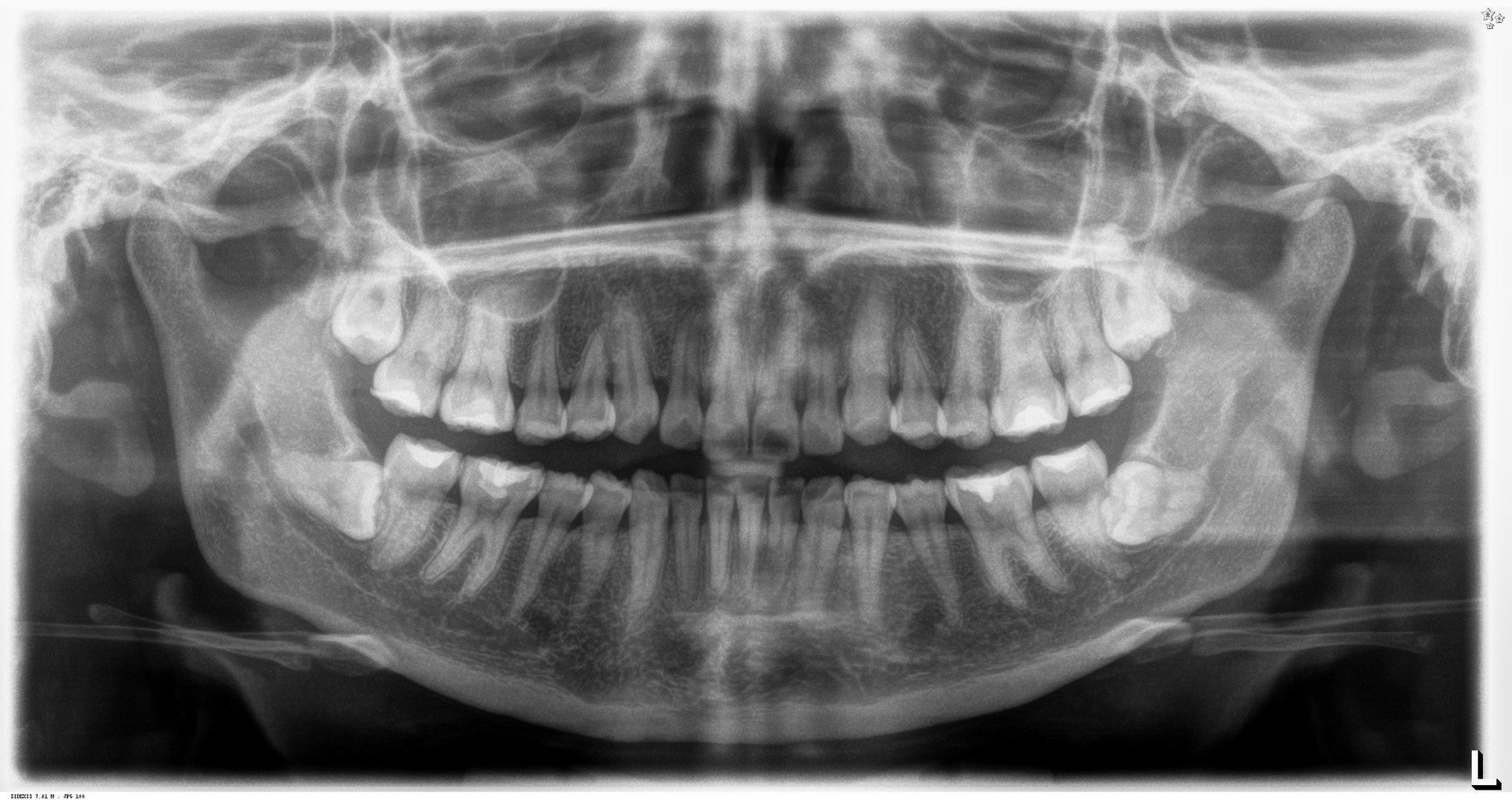 Descripción de imagen