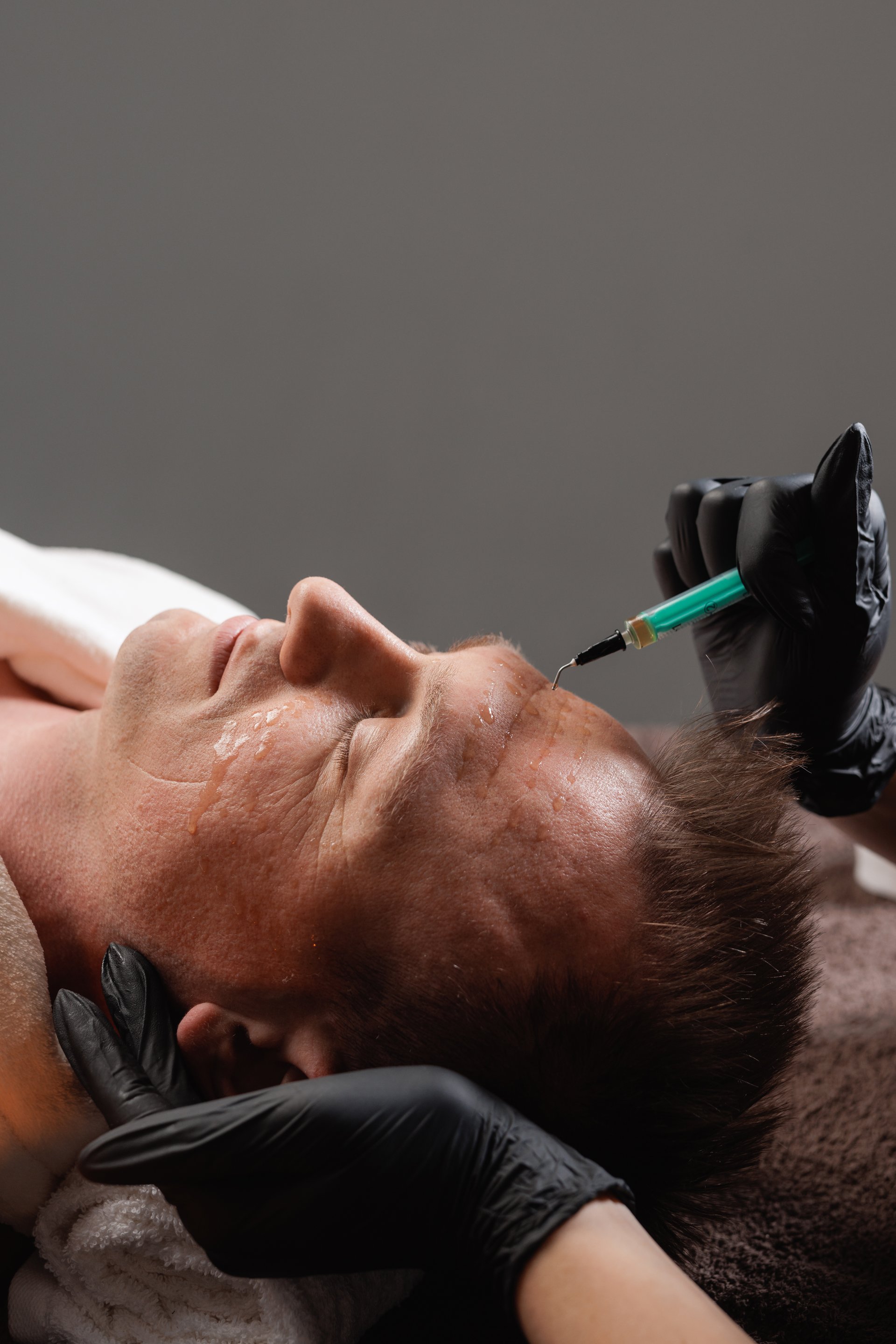 Close up of man receiving facial peeling with syringe, antiaging skincare procedure, rejuvenation treatment for men in modern spa or clinic.
