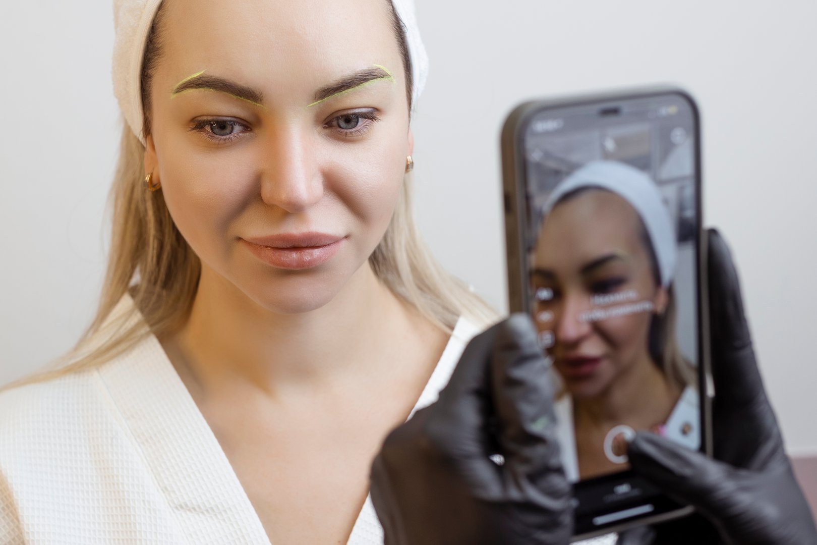 Hair Transplantation