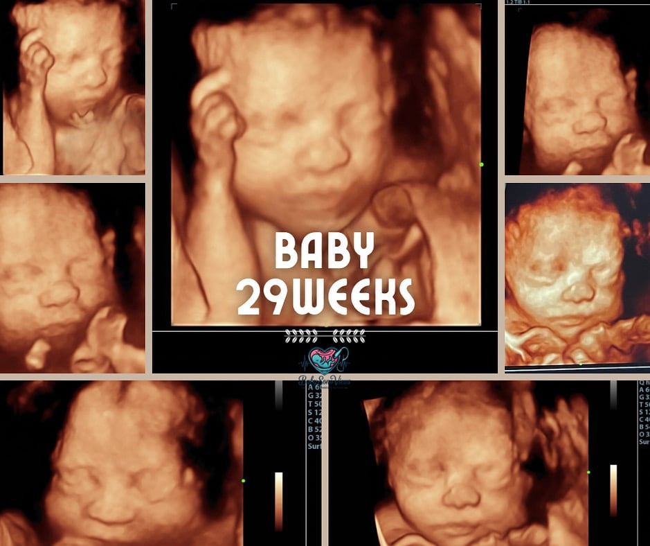 Premium ultrasound service