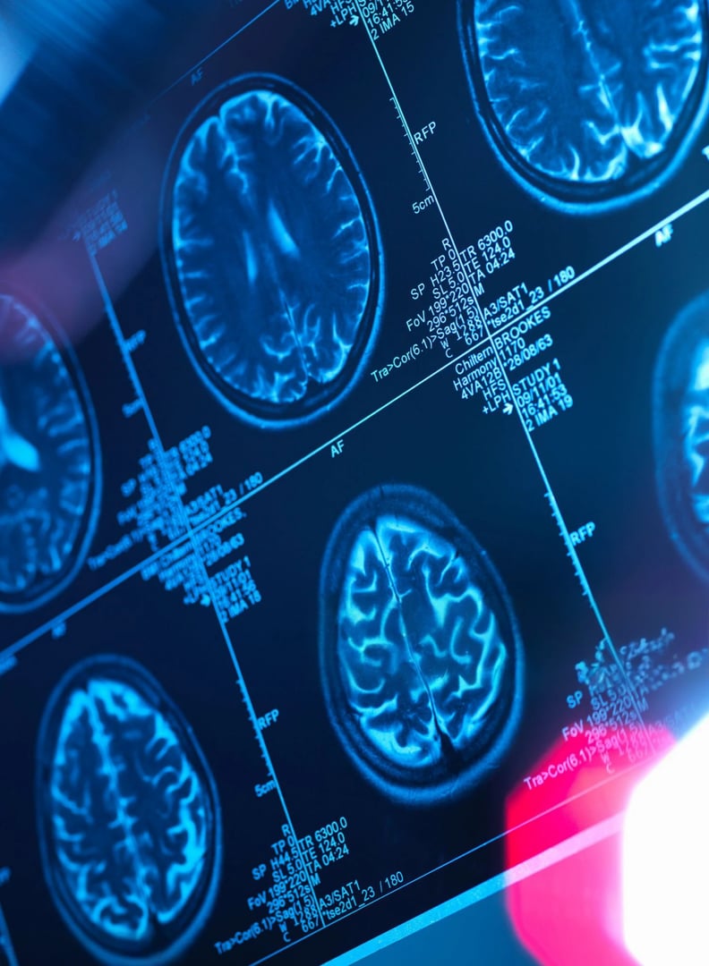A detailed view of a brain scan, highlighting intricate neurological structures and medical imaging data. The blue-toned image shows cross-sections.