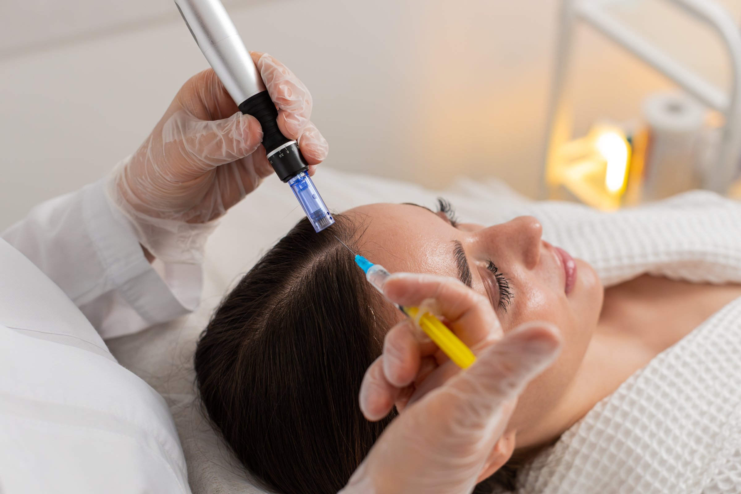 Caucasian girl undergoes scalp treatment to stimulate hair regrowth using microneedling dermapen and vitamin injections. Procedure performed by trichologist in cosmetology clinic for hair restoration.