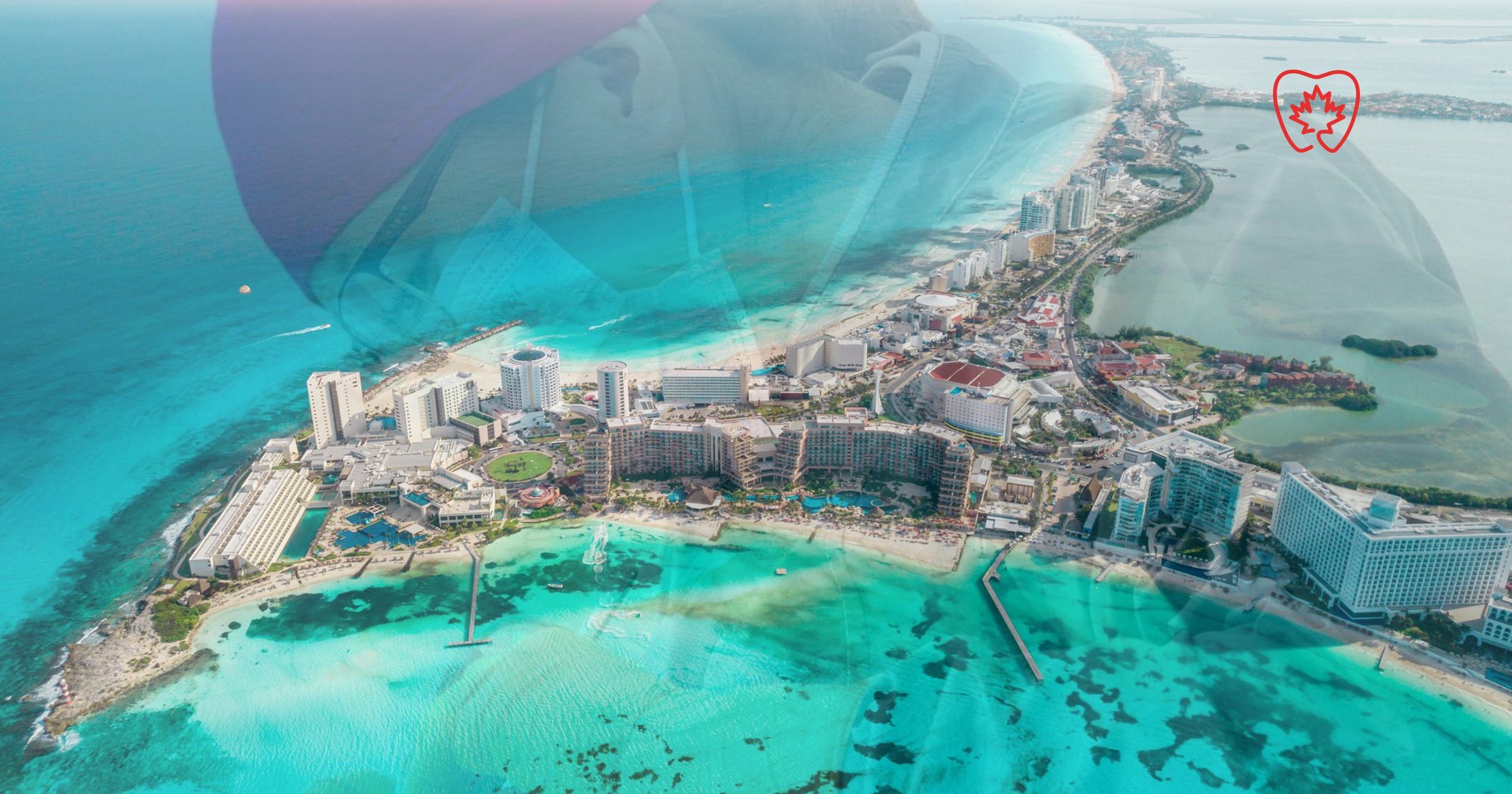 Dental care and smile makeover in Cancun, Mexico