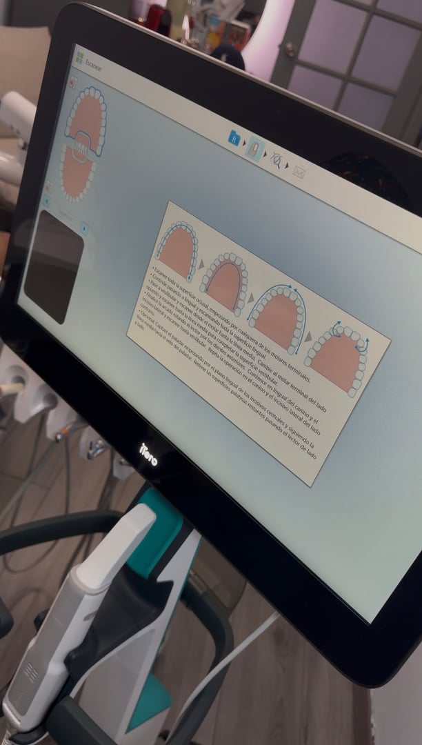 Escáner iTero - Tecnología de escaneo digital 3D en Mare Ortodoncia
