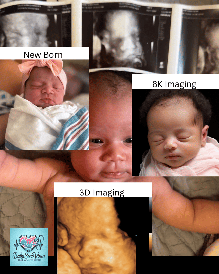 Ultrasound services showcase