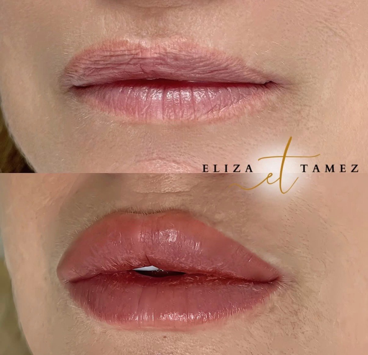 Micropigmentación de labios