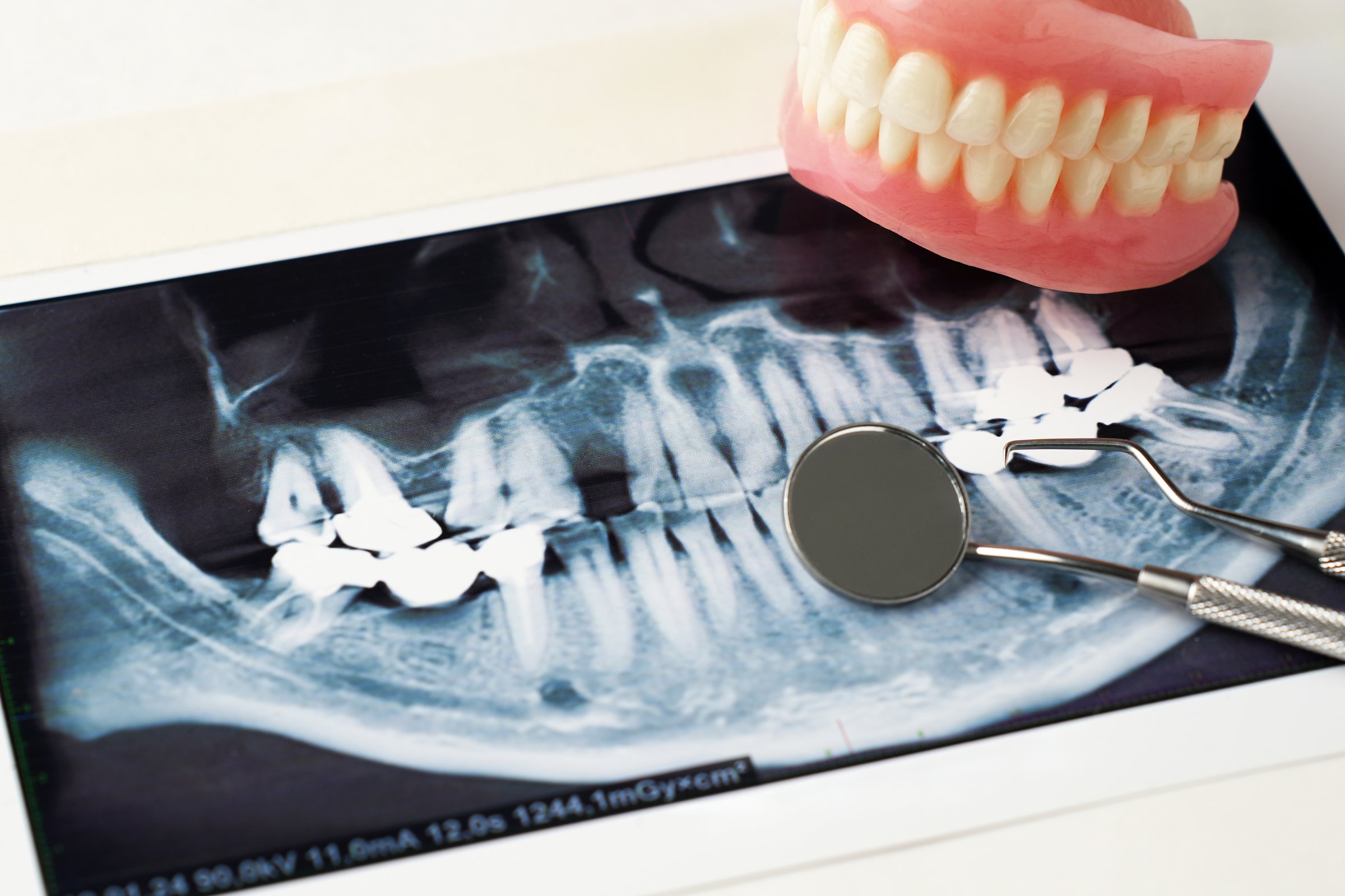 Dentures with Dental x-ray and dentist tool, close-up. Dental background with copy space
