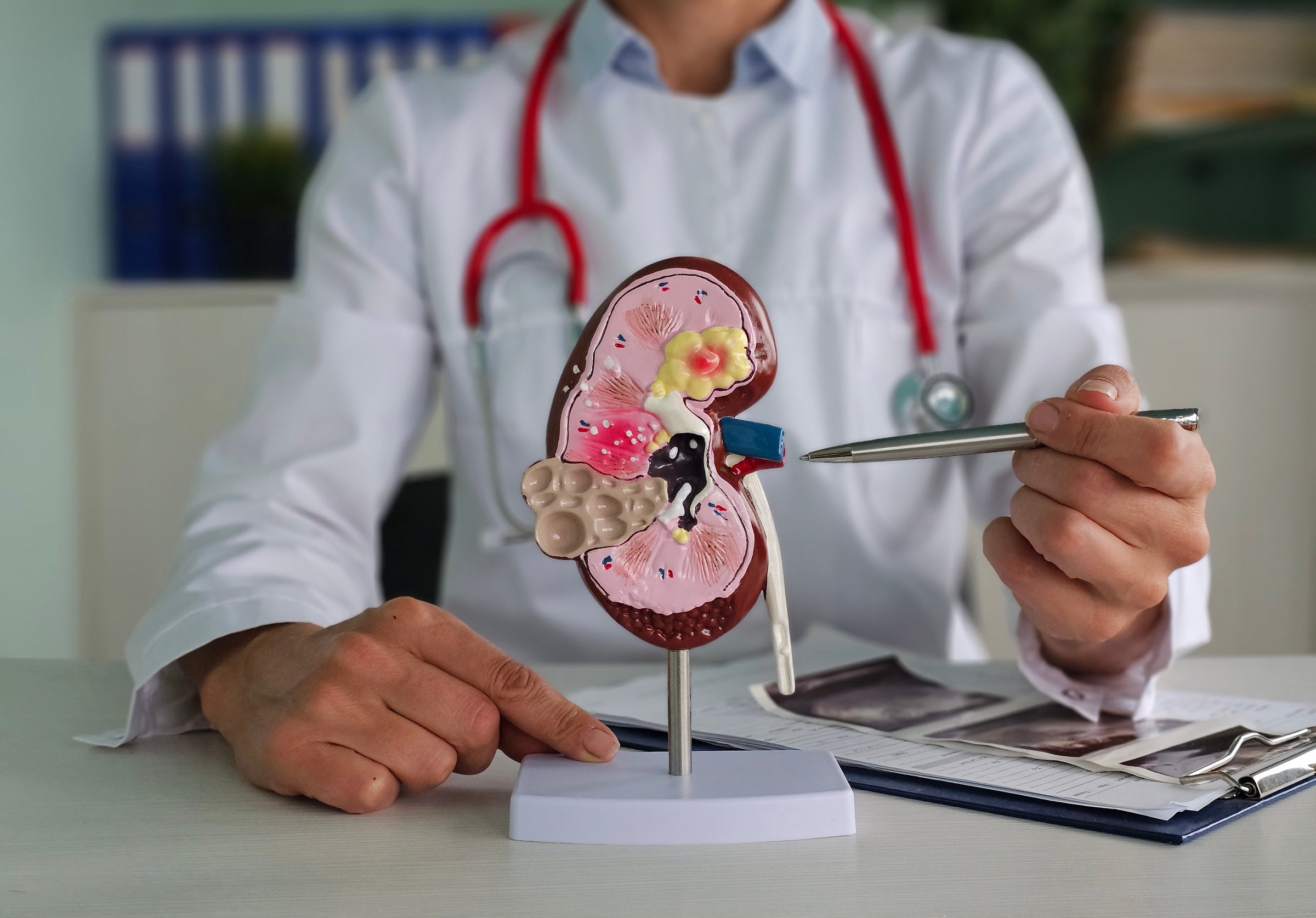 Urology and treatment of kidney diseases closeup. Transplant surgeon consultation