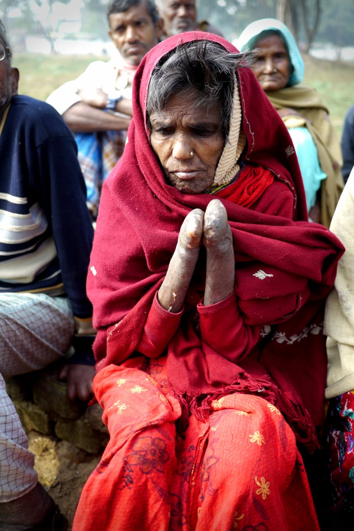 MUNGER, INDIA - 9 February 2014 : Leprosy patients in a remote leper colony in rural India gather together as a community outside the town of Munger.