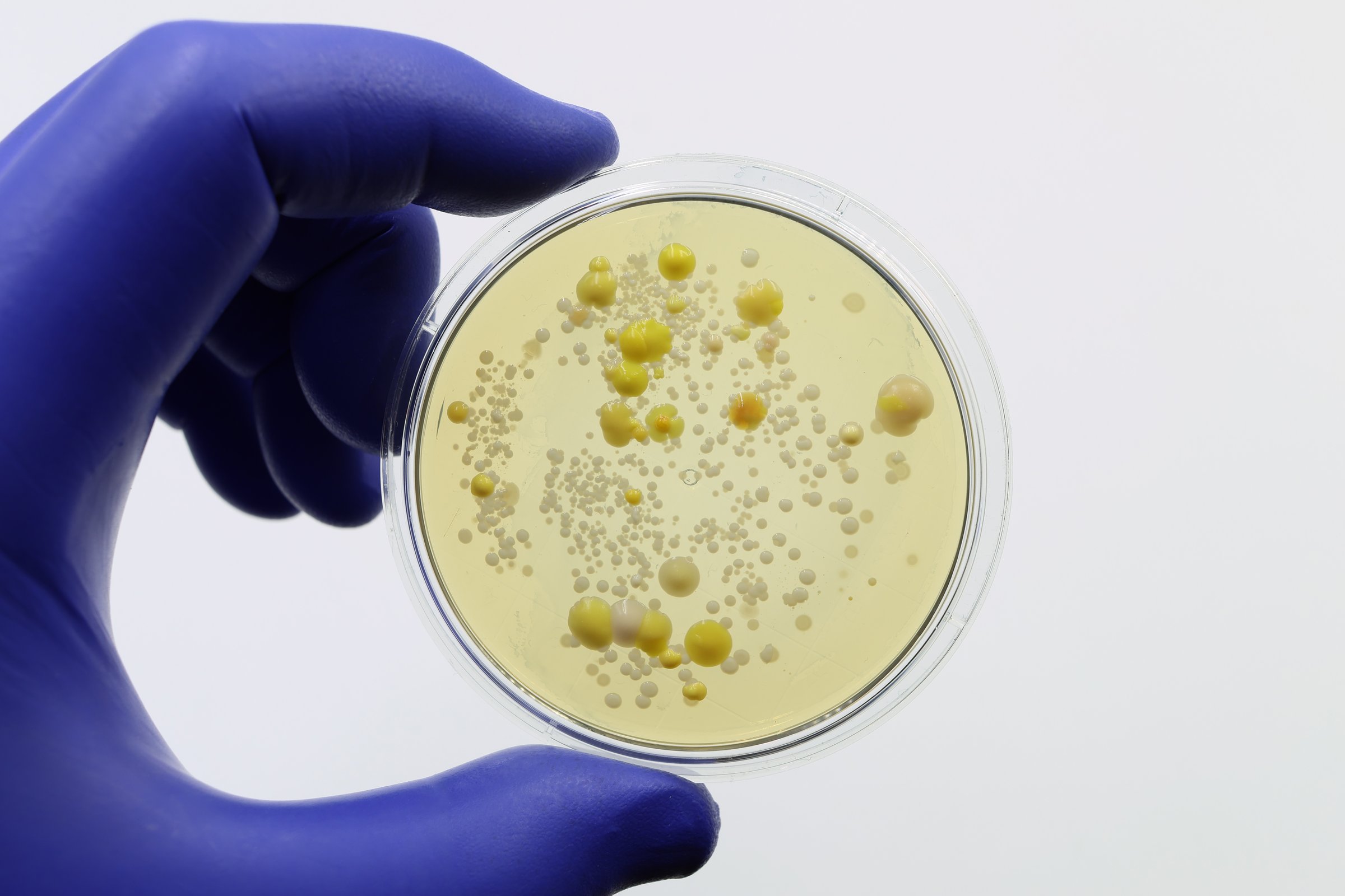 Doctor's or scientist's hand with a plate with colonies of bacteria isolated in the laboratory