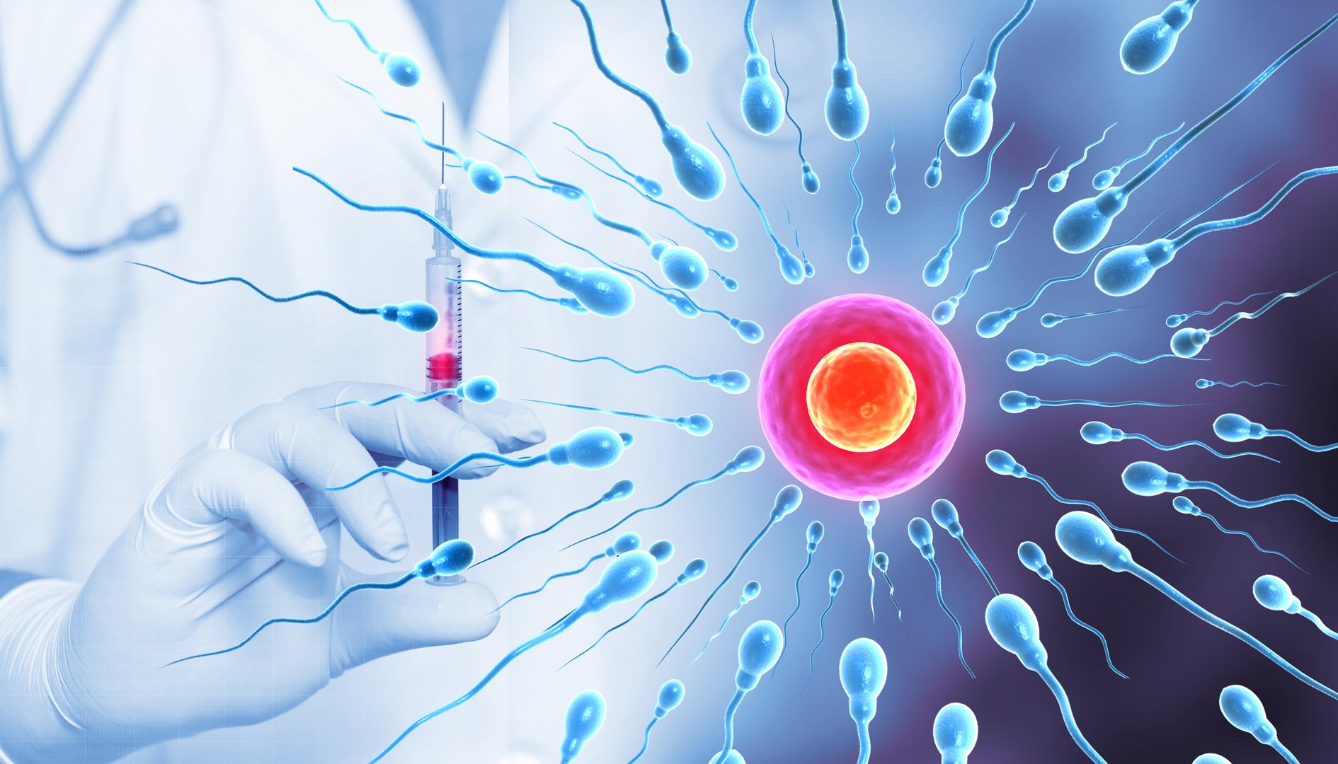 Embryo transfer procedure for IVF. 3d illustration