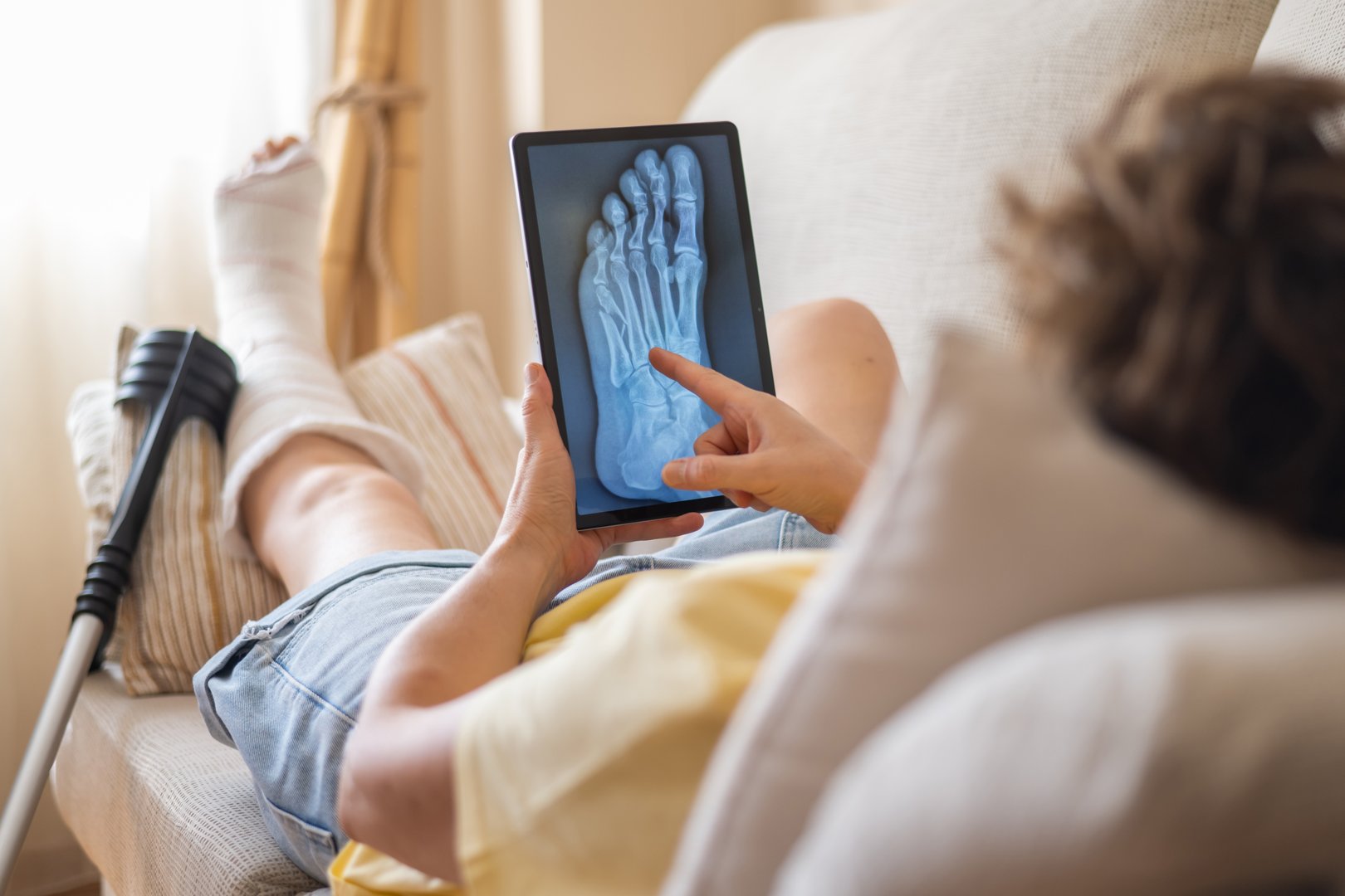 Patient with a broken foot in a cast, using crutches and examining an x-ray on a tablet while resting on the sofa, focusing on recovery and daily life