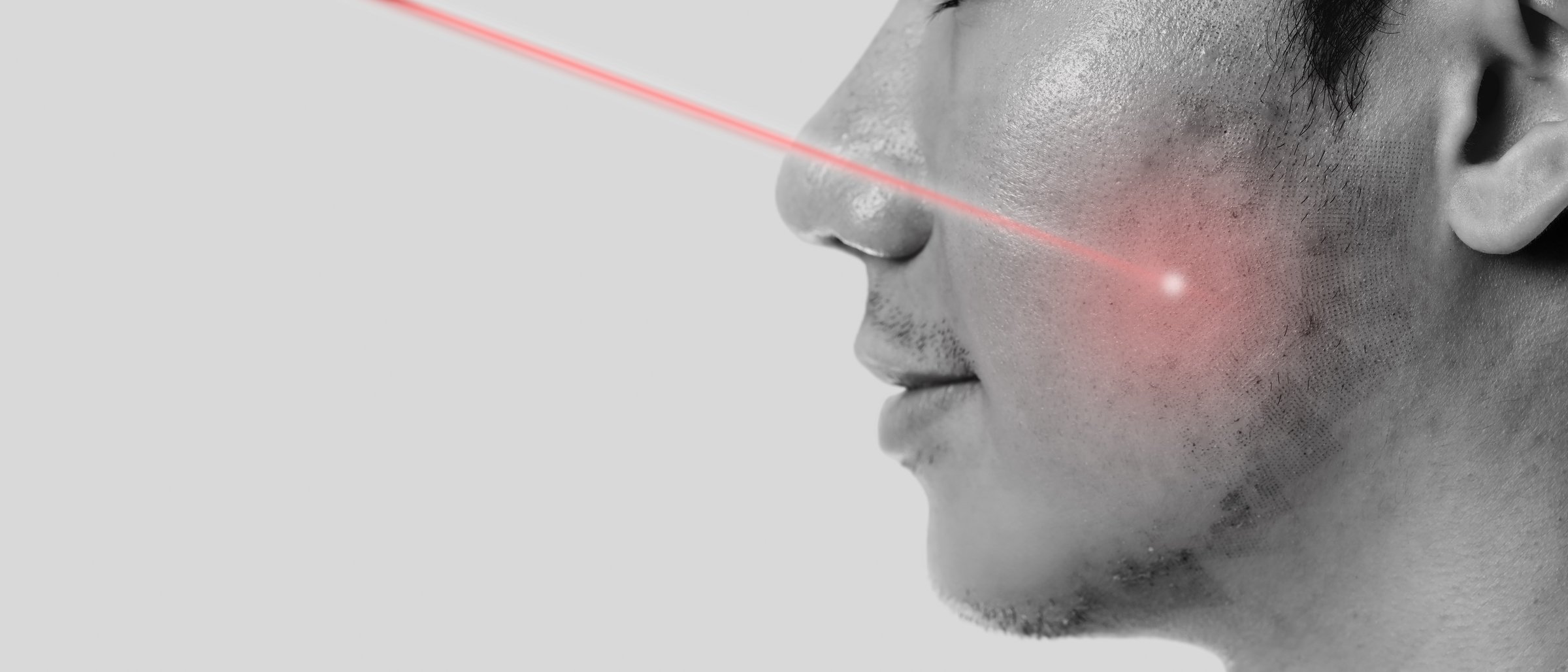 Side view of man face with blue bright laser beam directed at the skin for rejuvenation and perfect smooth skin.