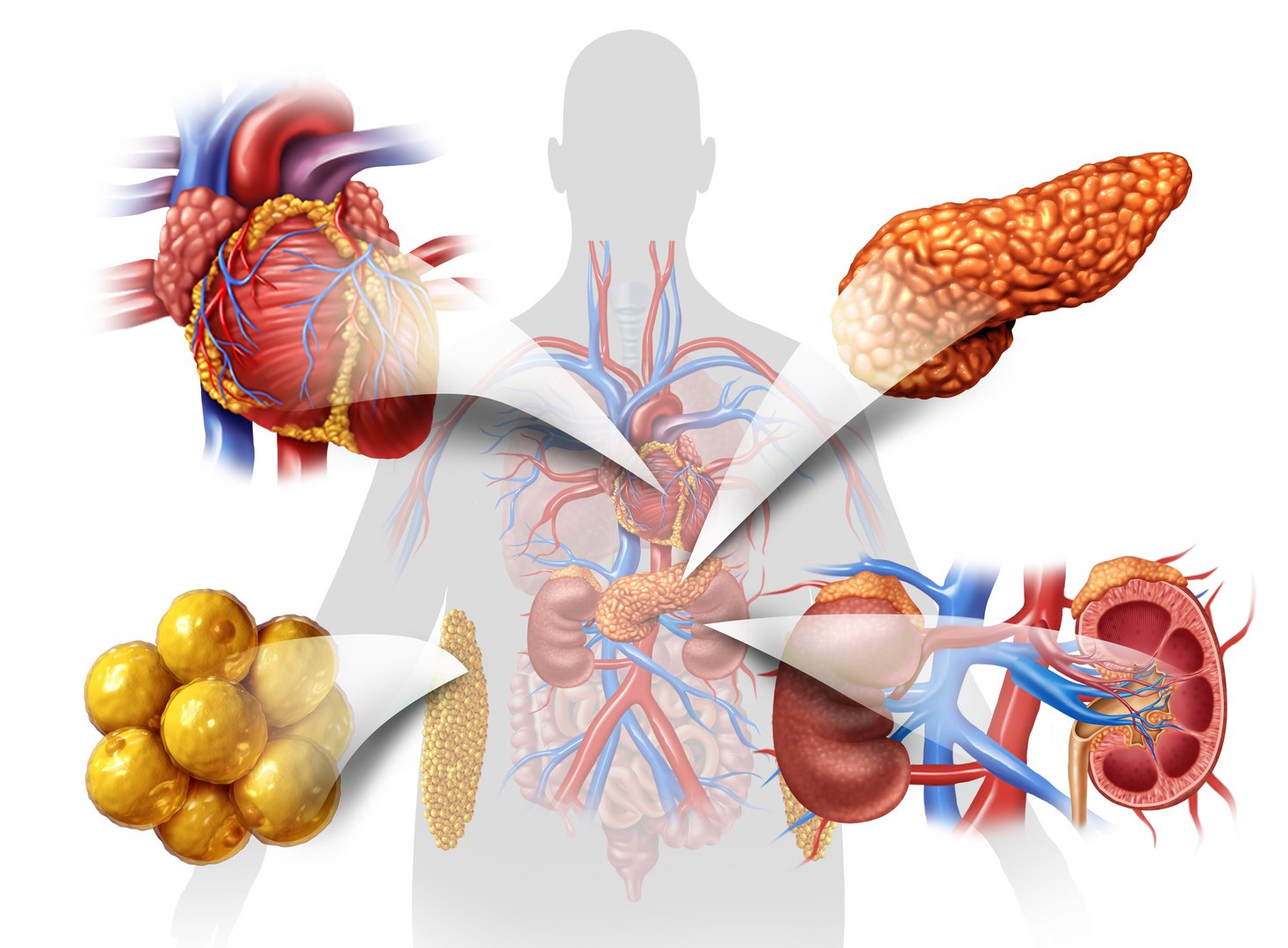 Cardiovascular kidney metabolic syndrome as a multisystem disorder as disease related to a group of organs as kidneys heart pancreas and Adipose cells.