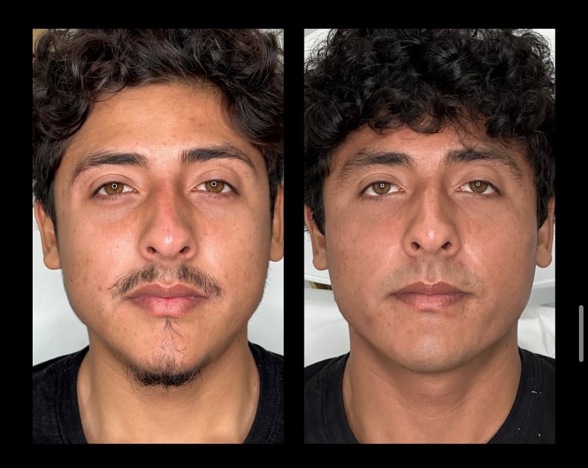 Full face aesthetic transformation