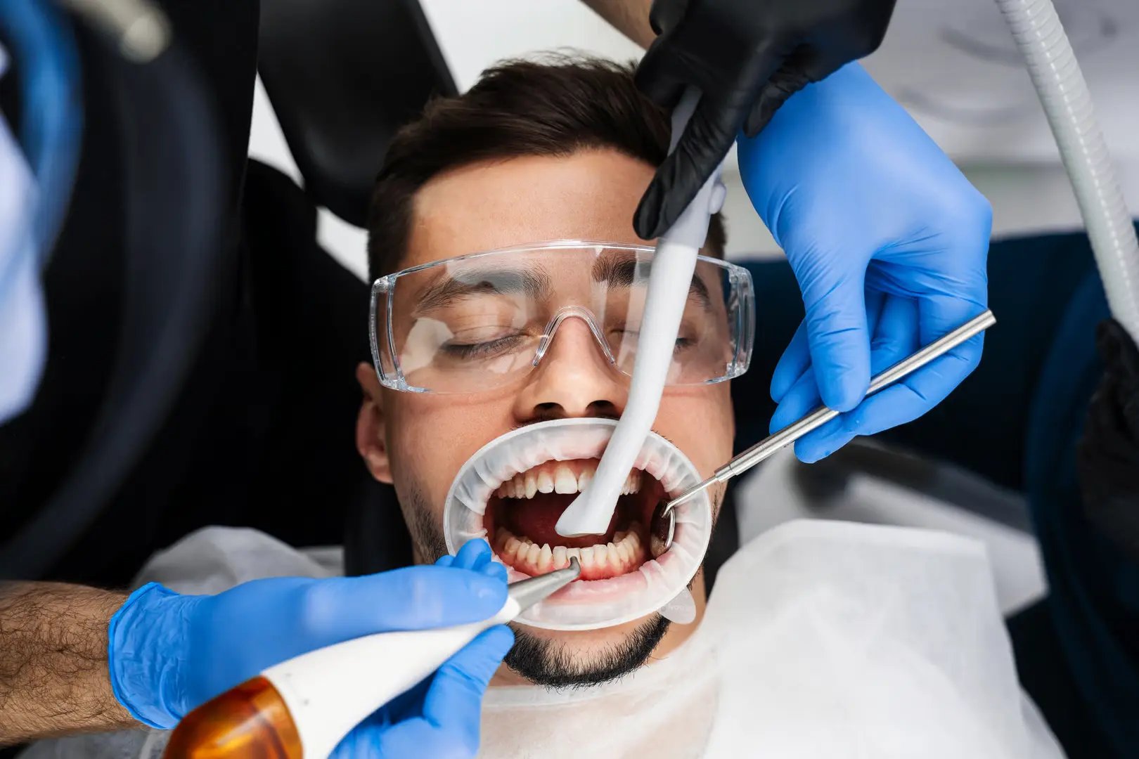 Closeup of unrecognizable female dentist using modern diode dental laser for periodontal care. Male patient wearing protective glasses, preventing eyesight damage. Periodontitis, dental hygiene.