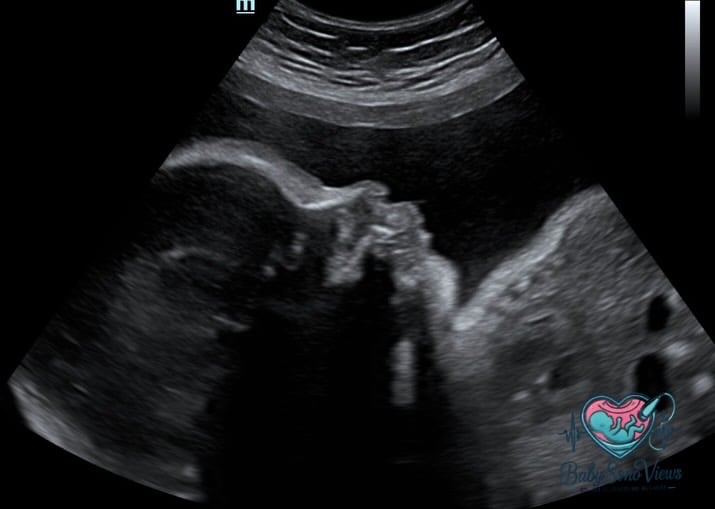 Ultrasound studio experience