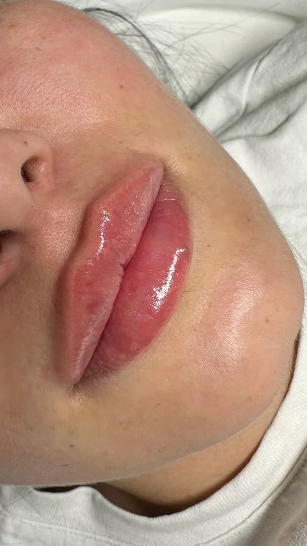 Результат роботи косметолога