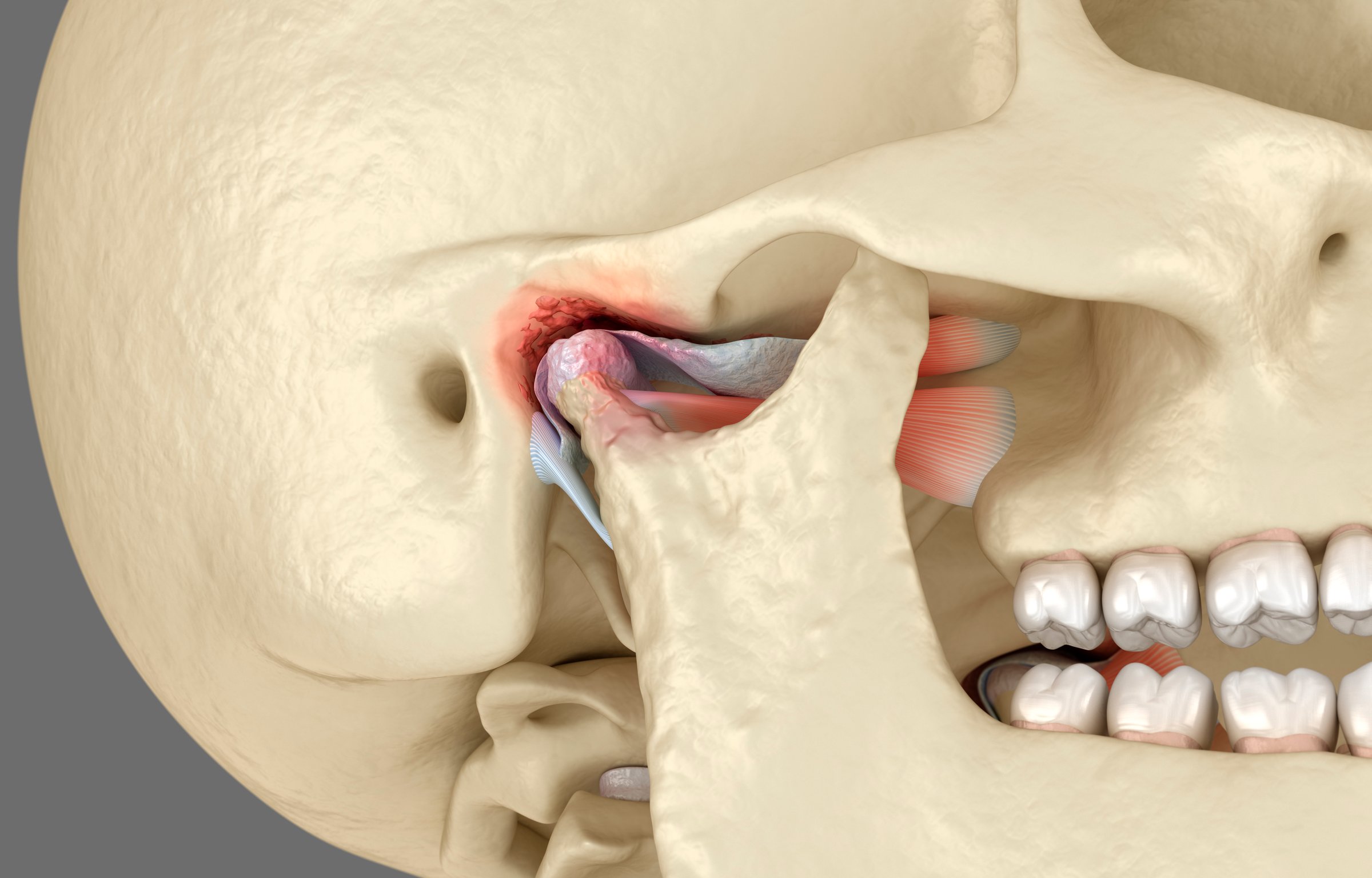 TMJ jaw joint illustration