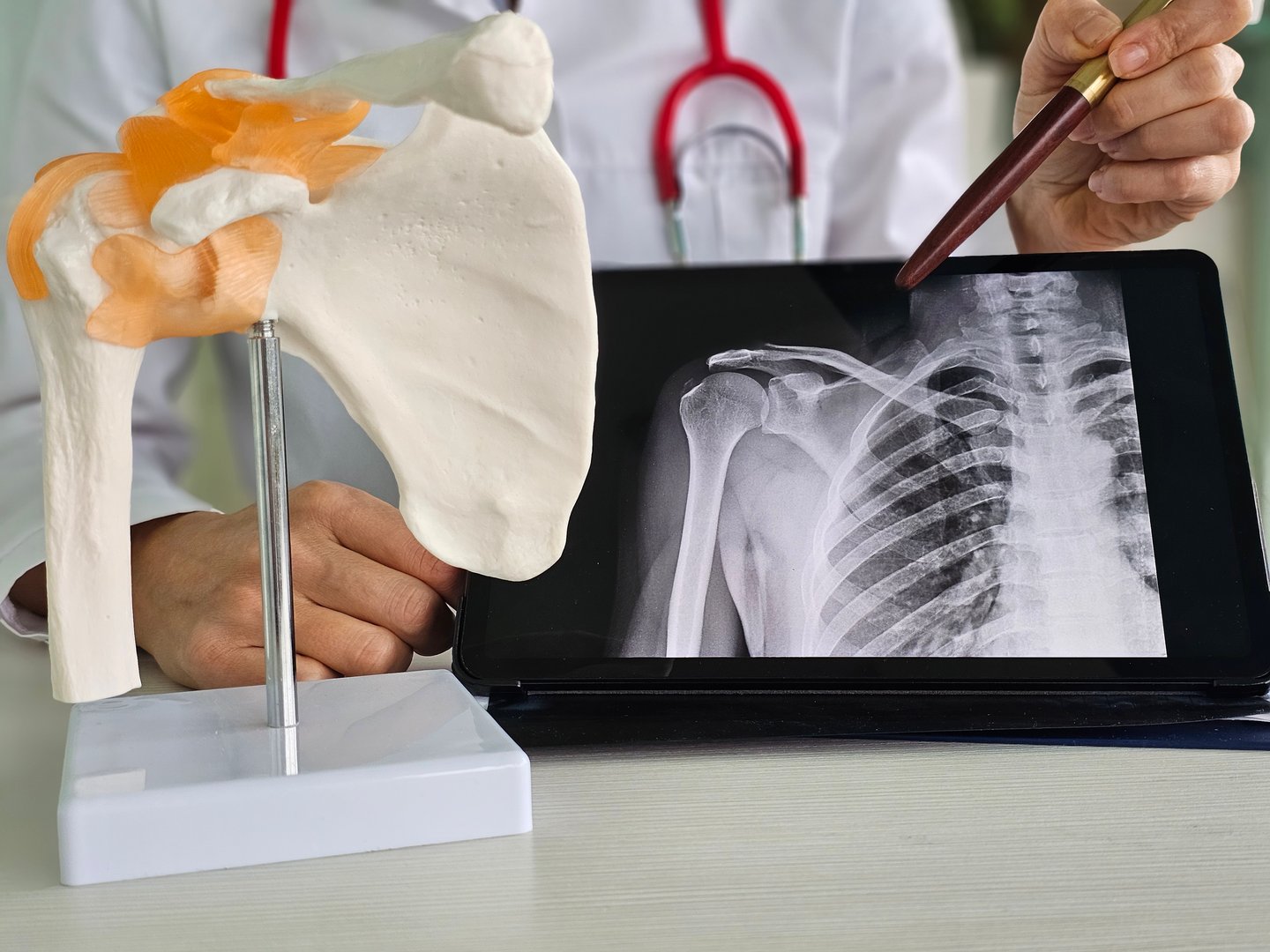 Medical professional demonstrating shoulder anatomy