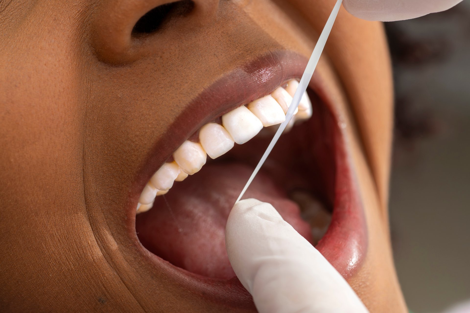 Dentist wearing gloves is cleaning patient's teeth with dental floss during a dental checkup