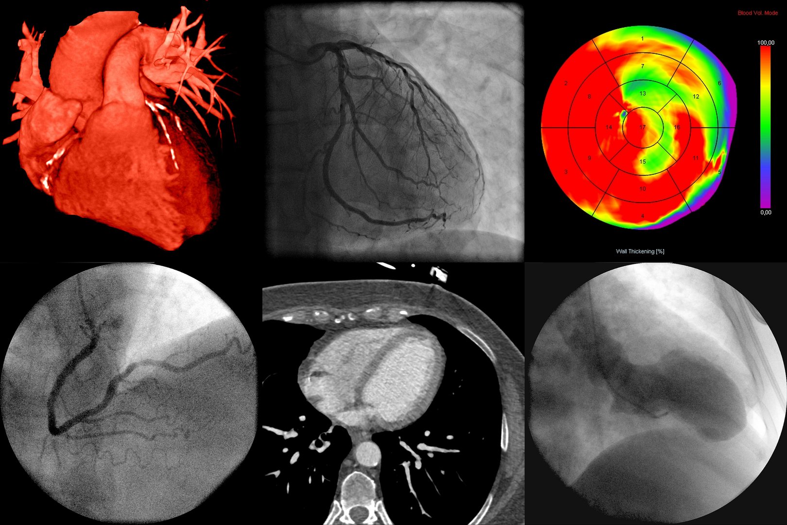 A series of cardiac imaging with different techniques