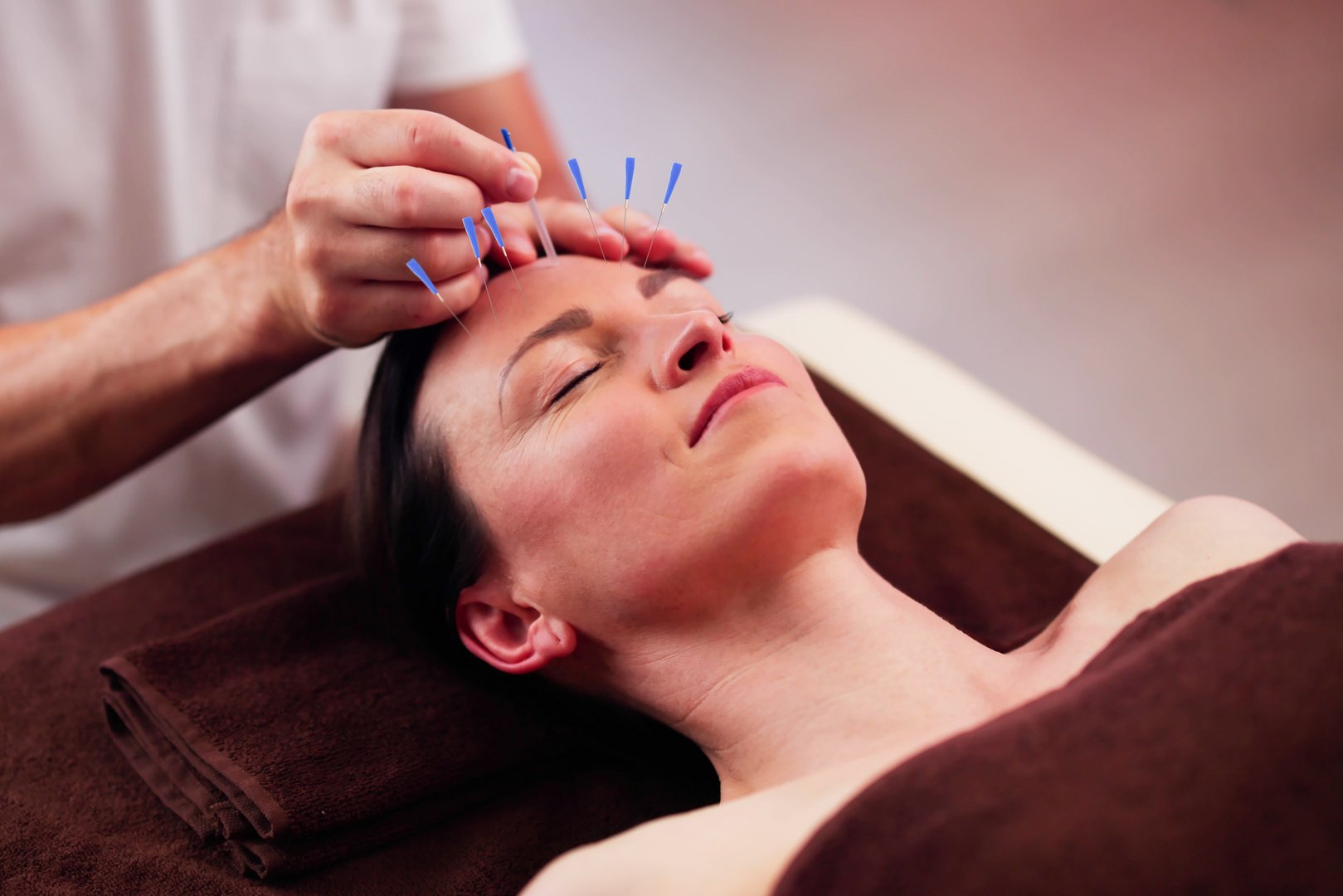 Relaxed Young Woman Receiving Acupuncture Treatment In Beauty Spa